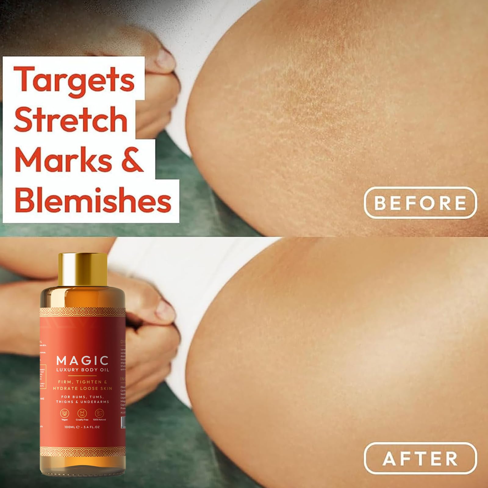 Aceite Corporal Besque Mágico Lujo Hidratante Multiusos 100ml para Brazos Pecho Muslos y Abdomen