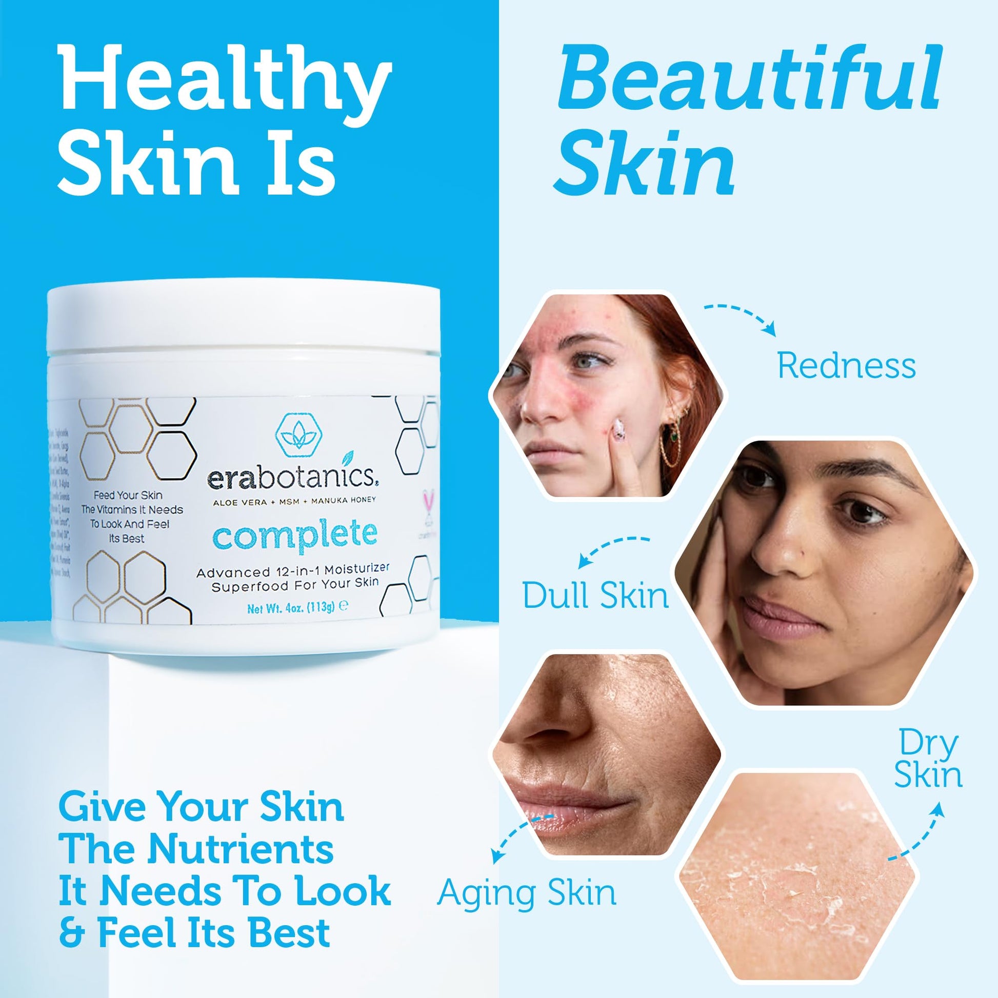Natural Face Moisturizer Cream 4oz Advanced Healing 10-in-1 Non Greasy Formula with Organic Aloe Vera, Manuka Honey, Coconut Oil & More. Best Face Cream for Oily, Dry, Damaged & Sensitive Skin