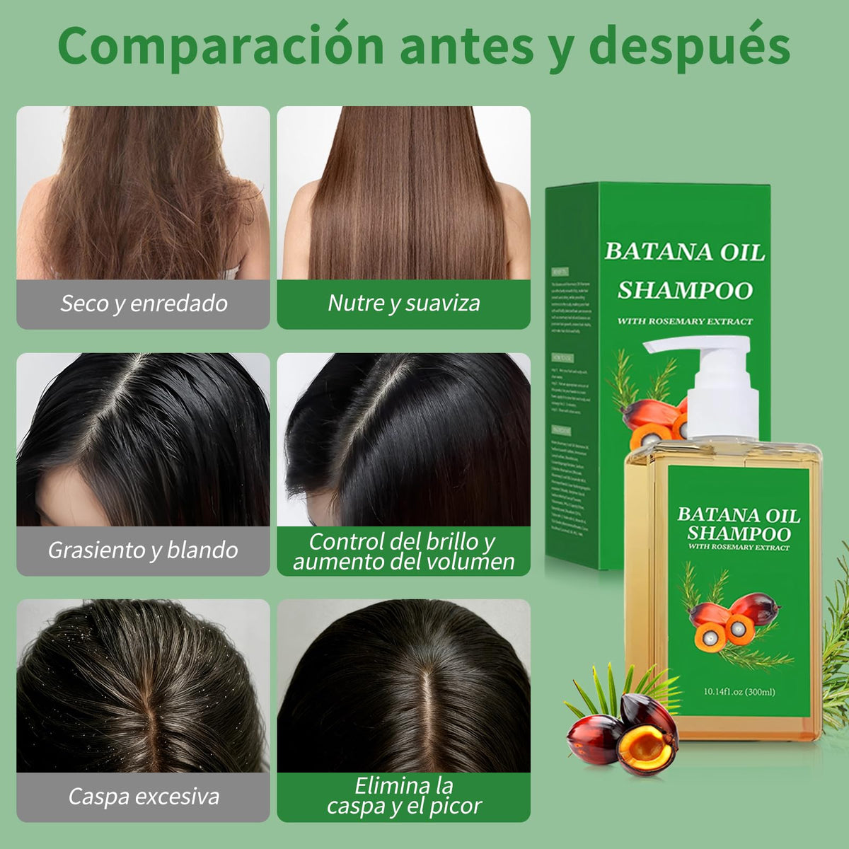 HNTCSR 2PCS Shampoo Romero,Champú de Aceite Battana de 300 ml para un Cabello Suave y con Volumen, Champú Anticaída Batana Repara el Cabello Seco y Dañado, Apto para Hombres y Mujeres