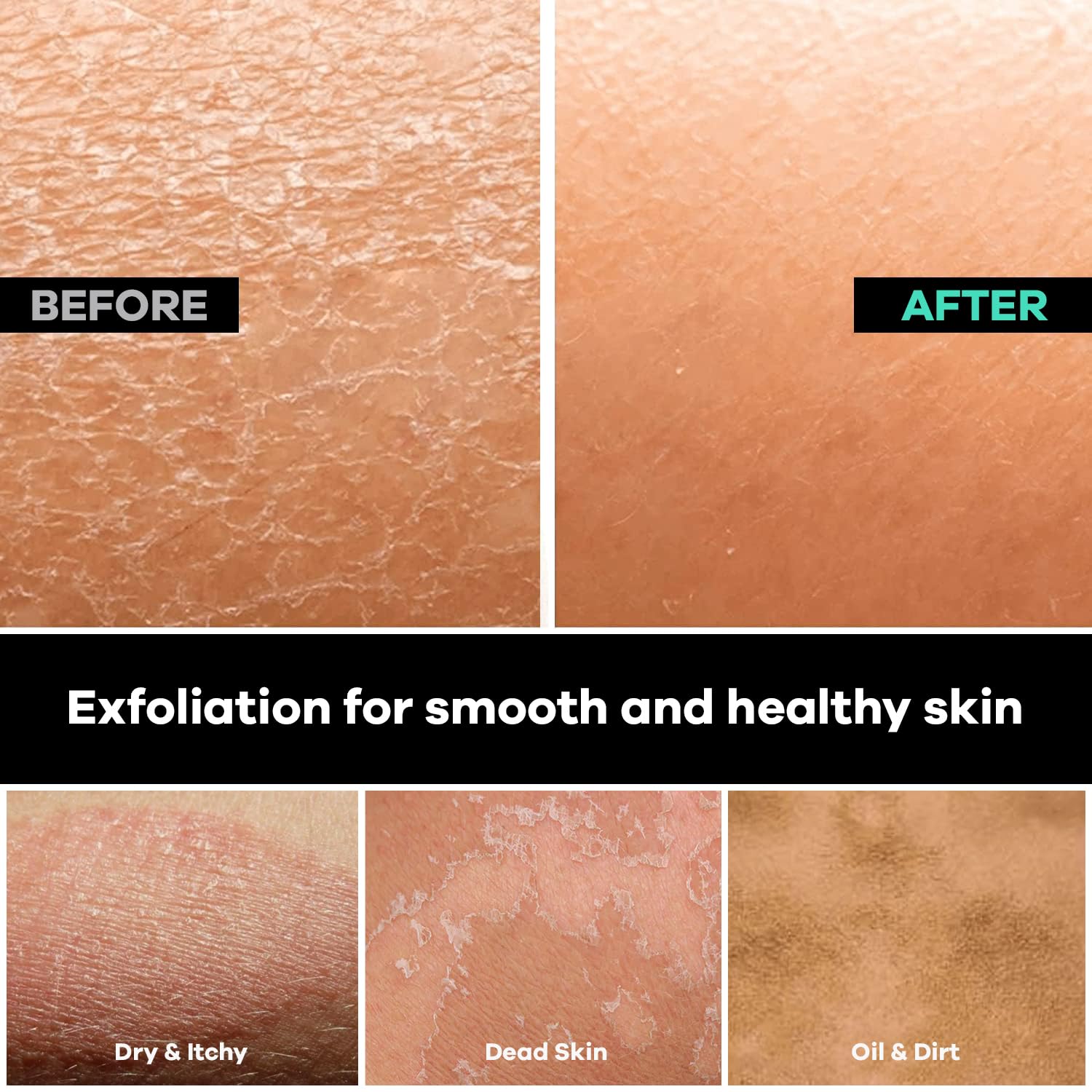 Dermasuri exfoliante profundo de la espalda exfoliante sin productos químicos exfoliación de la espalda exfoliante
