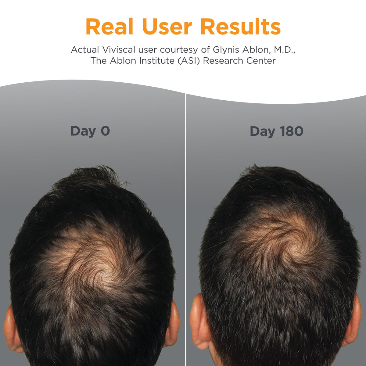 Suplementos para Crecimiento Capilar de Viviscal Hombre con Complejo de Colágeno Propietario, 60 Tabletas para Cabello Más Grueso y Abundante