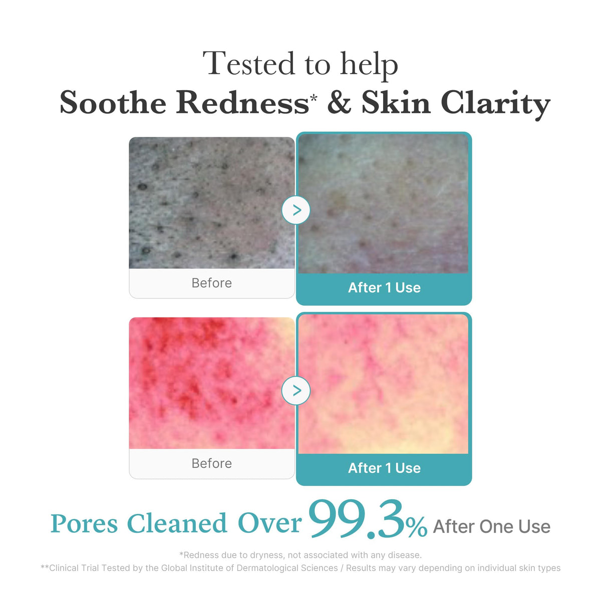 medicube Facial Cleanser Azelaic Acid Whip Cleanser | Soothing Cleansing Foam for Troubled Skin | Ideal for use after spot care, Excess Sebum Control | Niacinamide, Glycerin | Korean Skincare, 4.23 oz