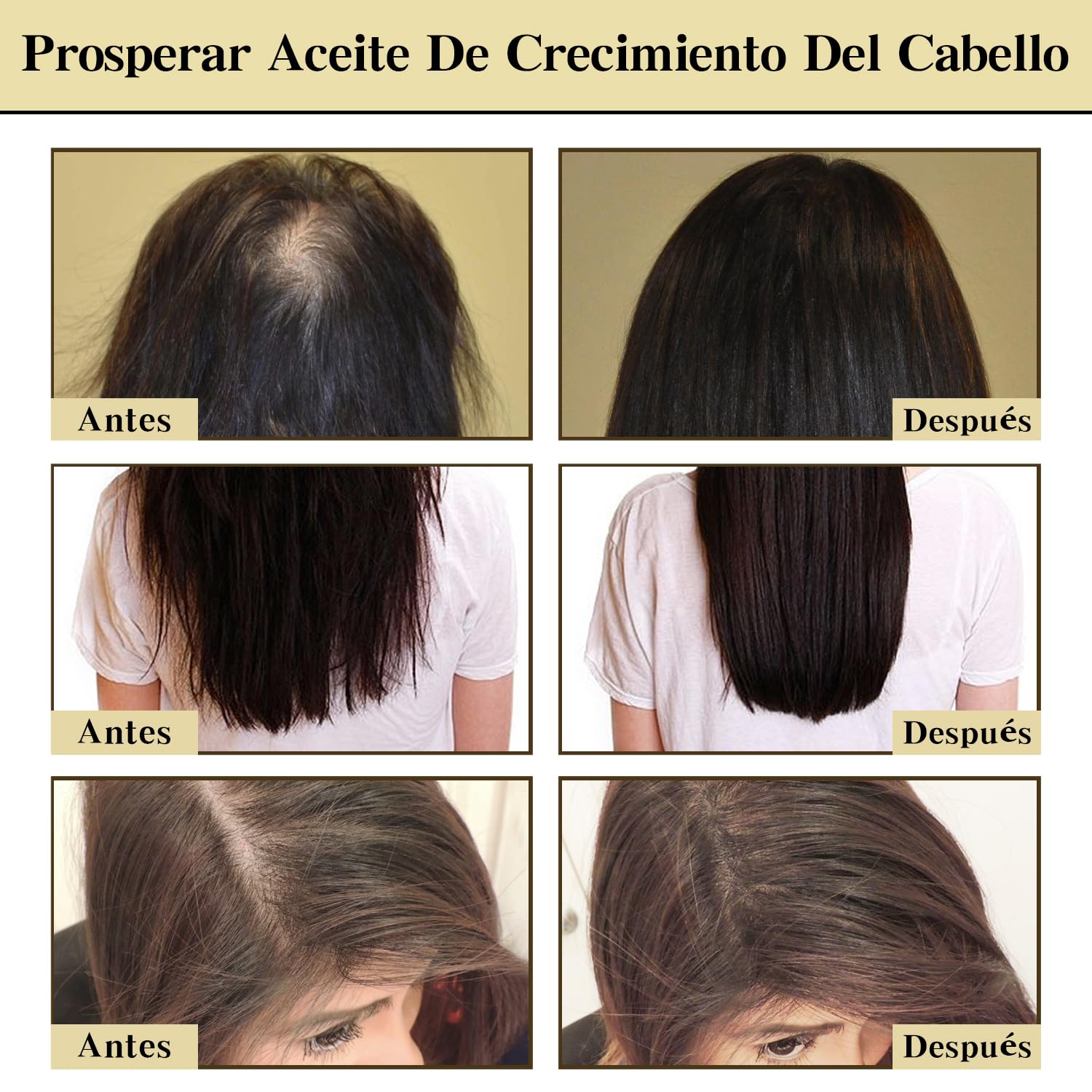 Conjunto Orgánico de Aceite de Romero para el Crecimiento del Cabello - Reducción de la Caída y Protección de la Salud Capilar. Tratamiento Natural para Estimular el Crecimiento y Fortalecer el Pelo. ¡Atrévete a Lucir una Melena Sana y Radiante!