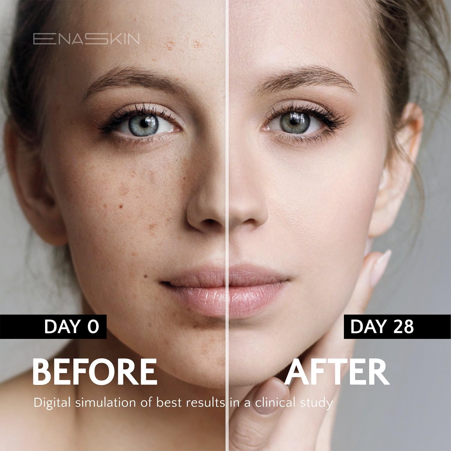 Suero Despigmentante Rostro y Cuerpo – Anti Manchas, Pecas y Melasma – 30 ml