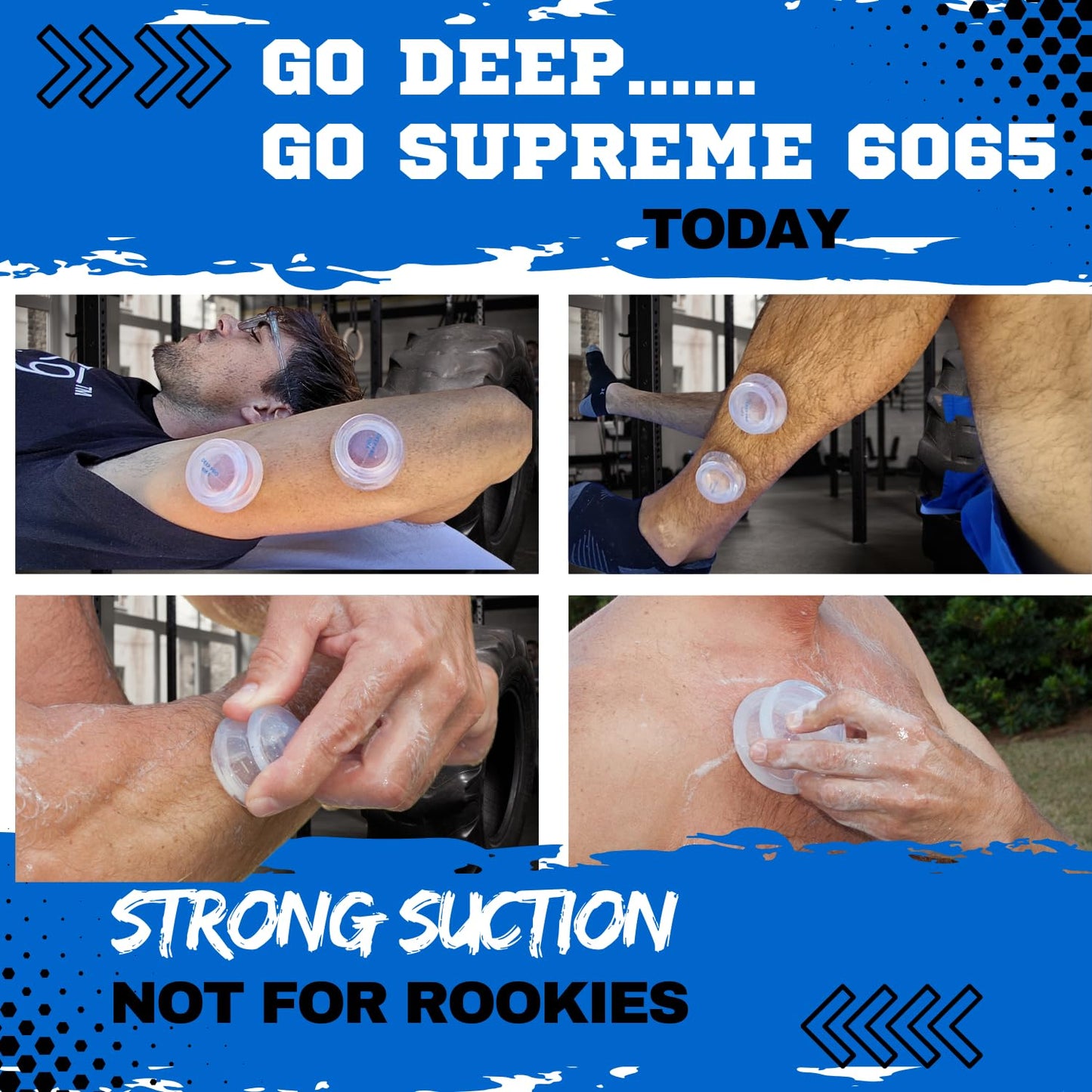 Cupping Warehouse Advanced Supreme 6 DEEP PRO 6065 Juego de terapia de ventosas profesional. Ventosas terapeuticas. Juego de ventosas de silicona mas dura para ventosas de masaje profundo.