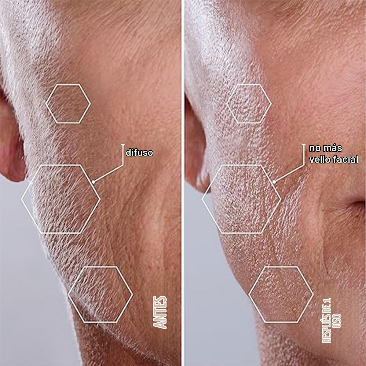 Michael Todd Beauty - Sonicsmooth Dermaplaning Tool - 2 en 1 Peach Fuzz Depilación Facial para Mujeres - Dermaplane - Recargable con suministro de 8 semanas