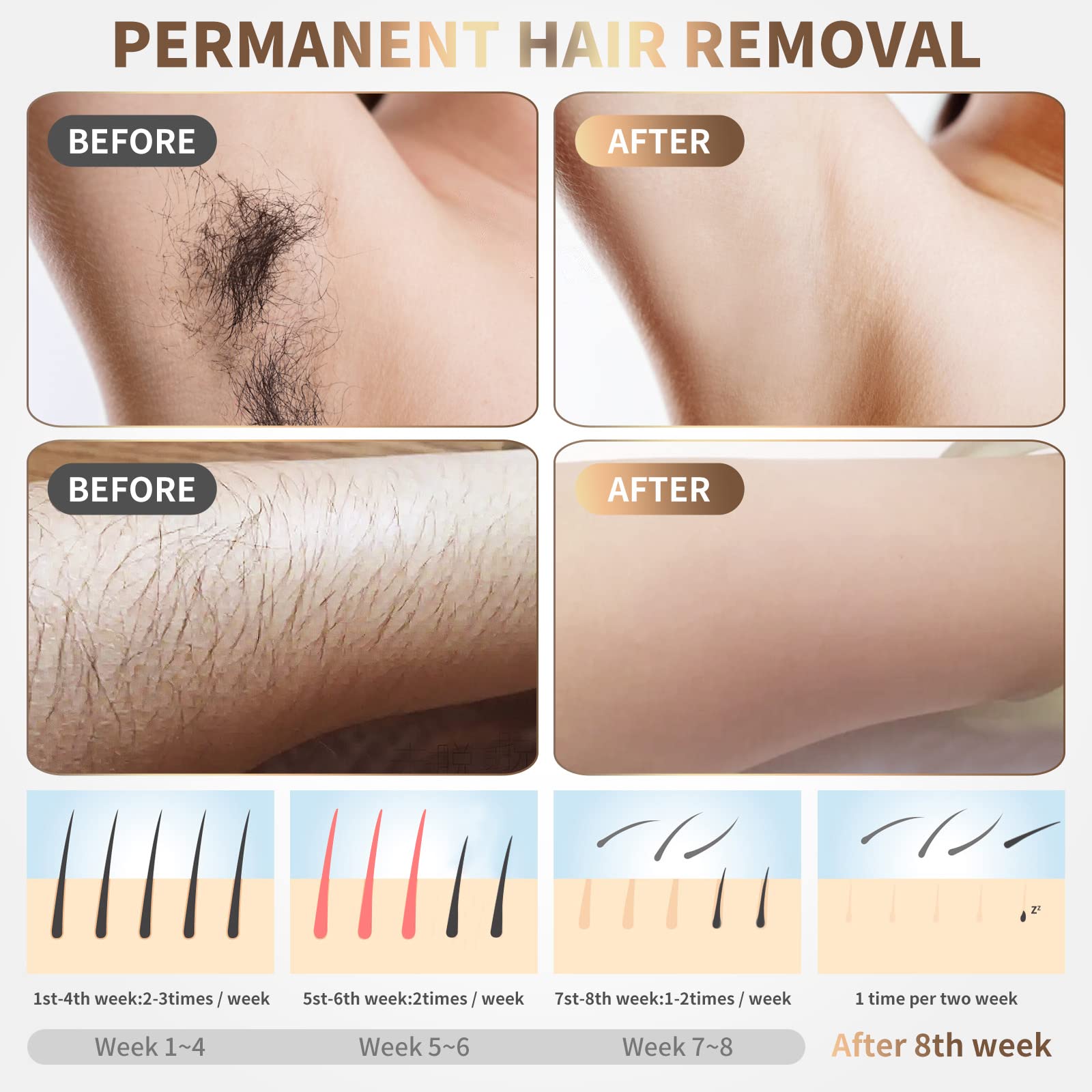 Gransumr Dispositivo de depilación láser IPL en el hogar Eliminador de vello permanente e indoloro para mujeres y hombres Mejor cuerpo completo Facial Cara Axilas Piernas traseras Brazos Cara Línea d