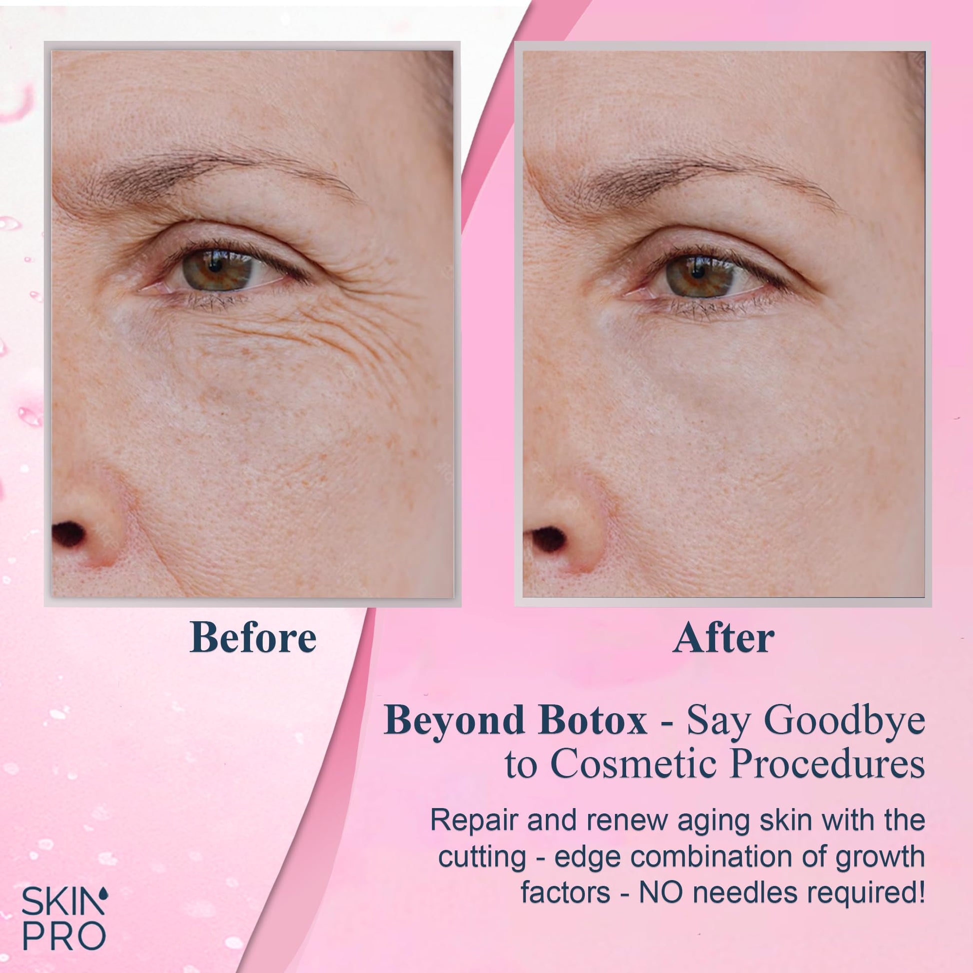 Skin Pro Skin Care - Suero facial de factor de crecimiento PRP, factor de crecimiento epidérmico, HGF, IGF, aceite facial de suero facial para arrugas, suero para cara, cuidado facial, suero para ojos, suero hidratante