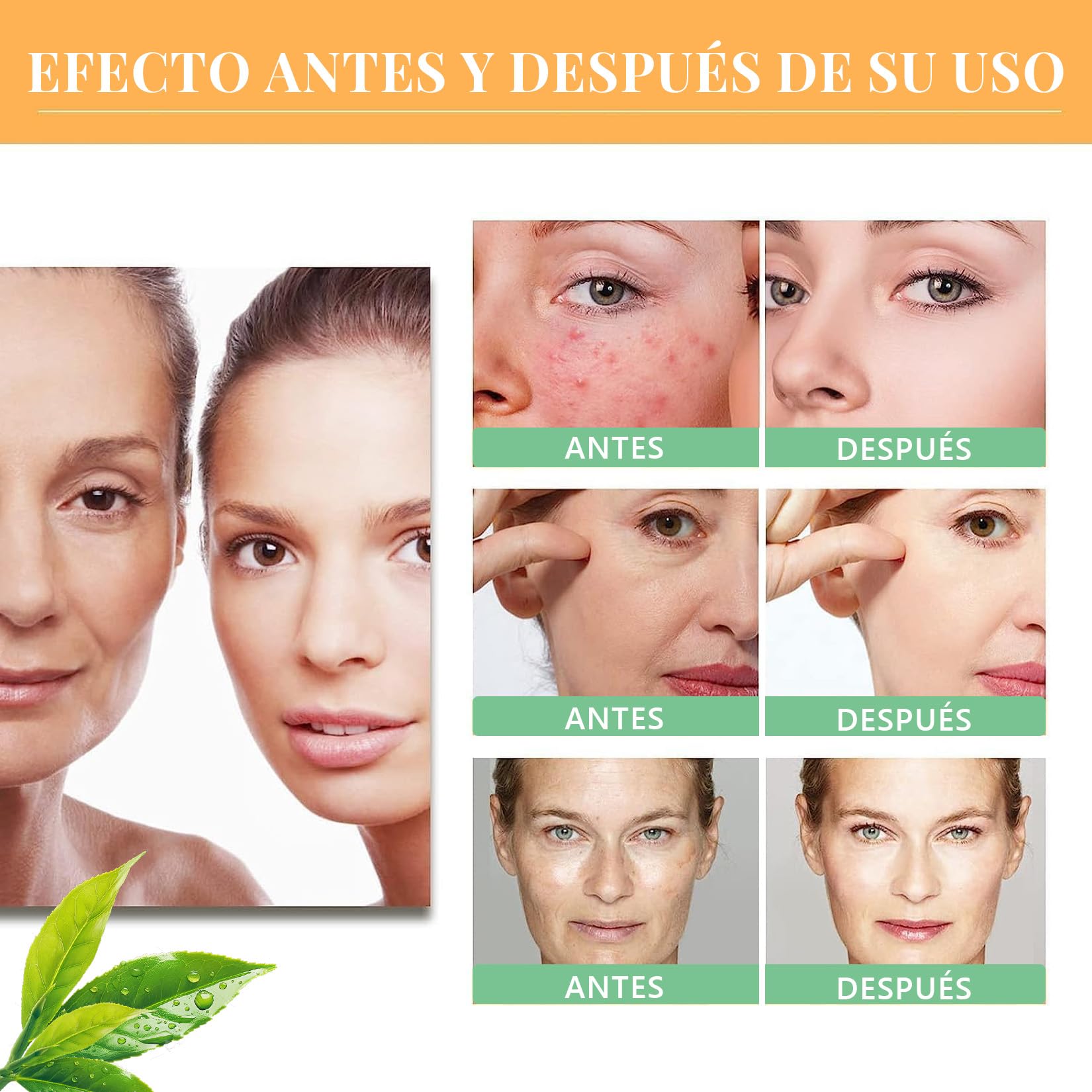 Tónico Facial Ácido Glicólico 7% 240ml para Manchas y Acné - Exfoliante y Rejuvenecedor de Piel Grasa - Tonificante y Despigmentante - Solución Reafirmante SEO