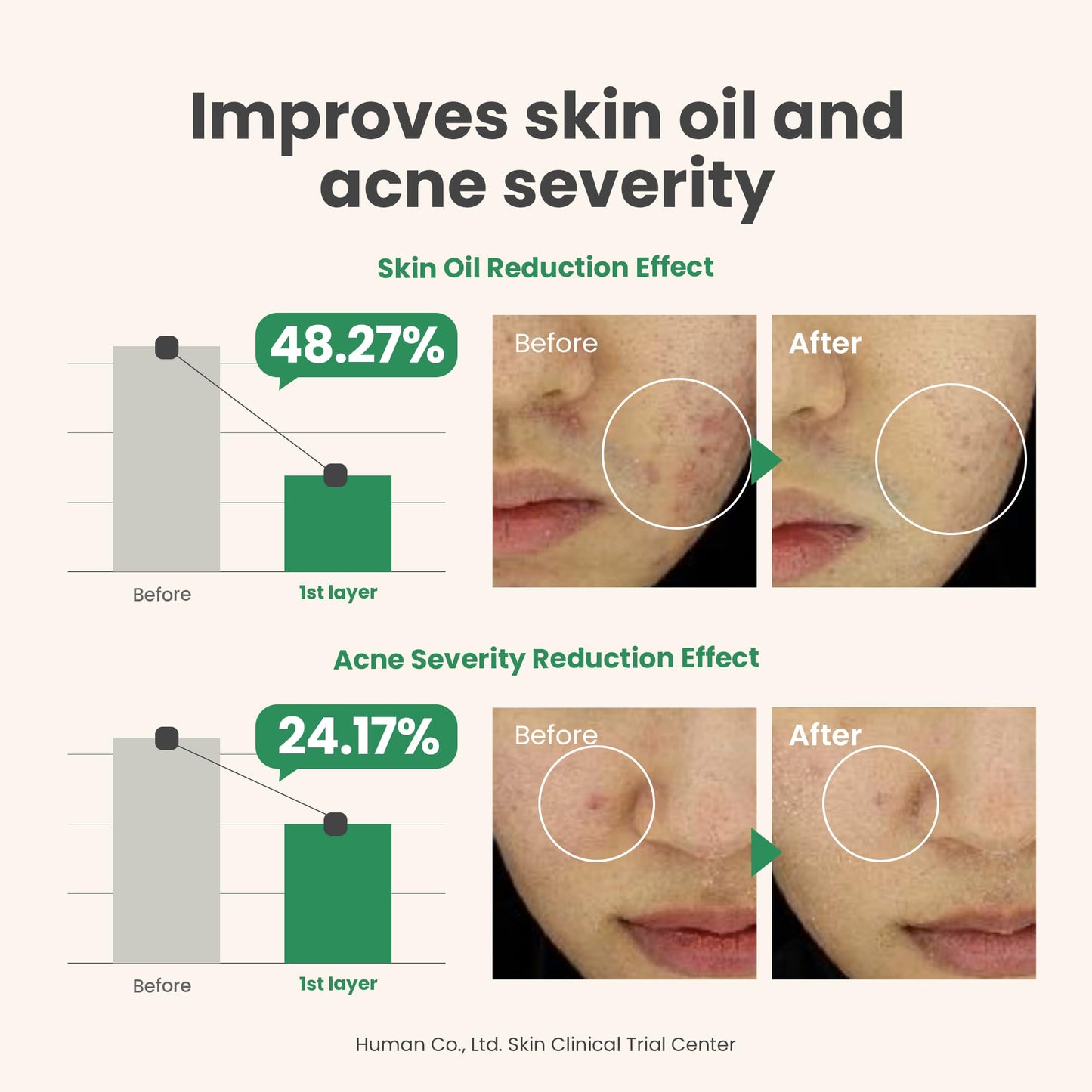 AXIS-Y Spot the Difference Blemish Treatment - Tratamiento anti brotes e imperfecciones para pieles sensibles, grasas y propensas al acné 15ML