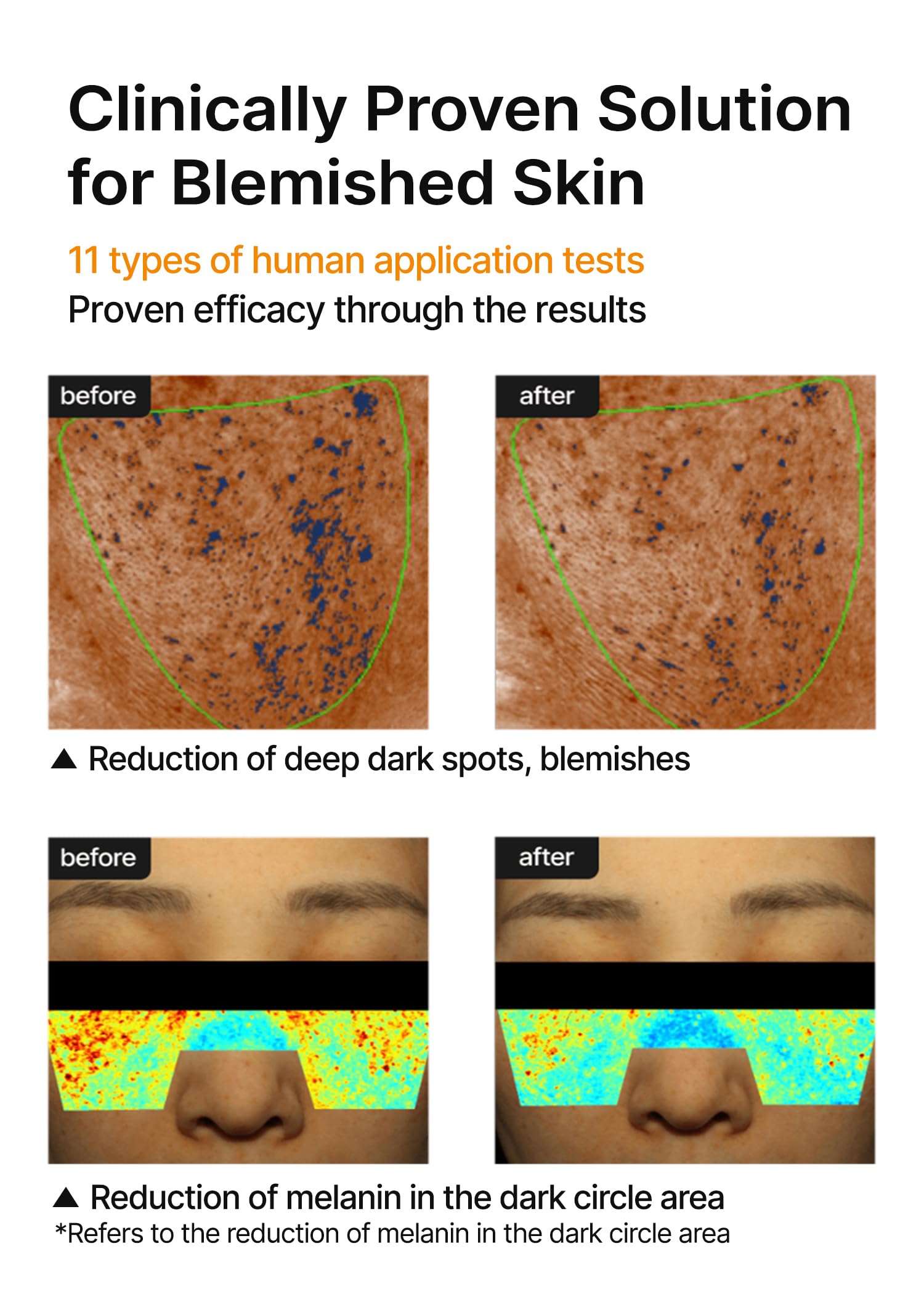 celimax Crema iluminadora de manchas oscuras Pore+, Con niacinamida, ácido tranexámico, crema TXA, minimizadora de poros, no irritante, hidratante, para pieles sensibles, crema de uso diario, 35 m