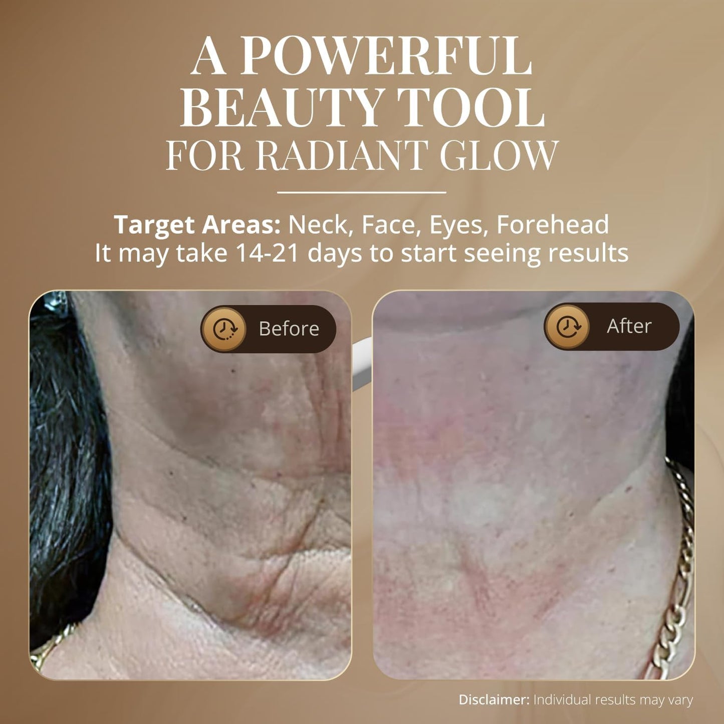 GLO24K - Dispositivo de belleza para rejuvenecimiento de la piel para cara y cuello, basado en tecnología LED de triple acción, térmica y vibración. Levanta y aprieta la piel flácida para una apariencia radiante.