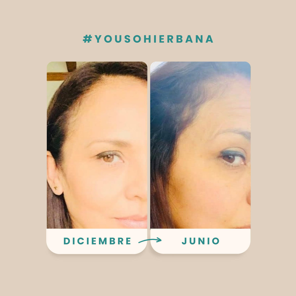 Loción Capilar Hierbana Estimulante para Nacimiento de Cabello Nuevo