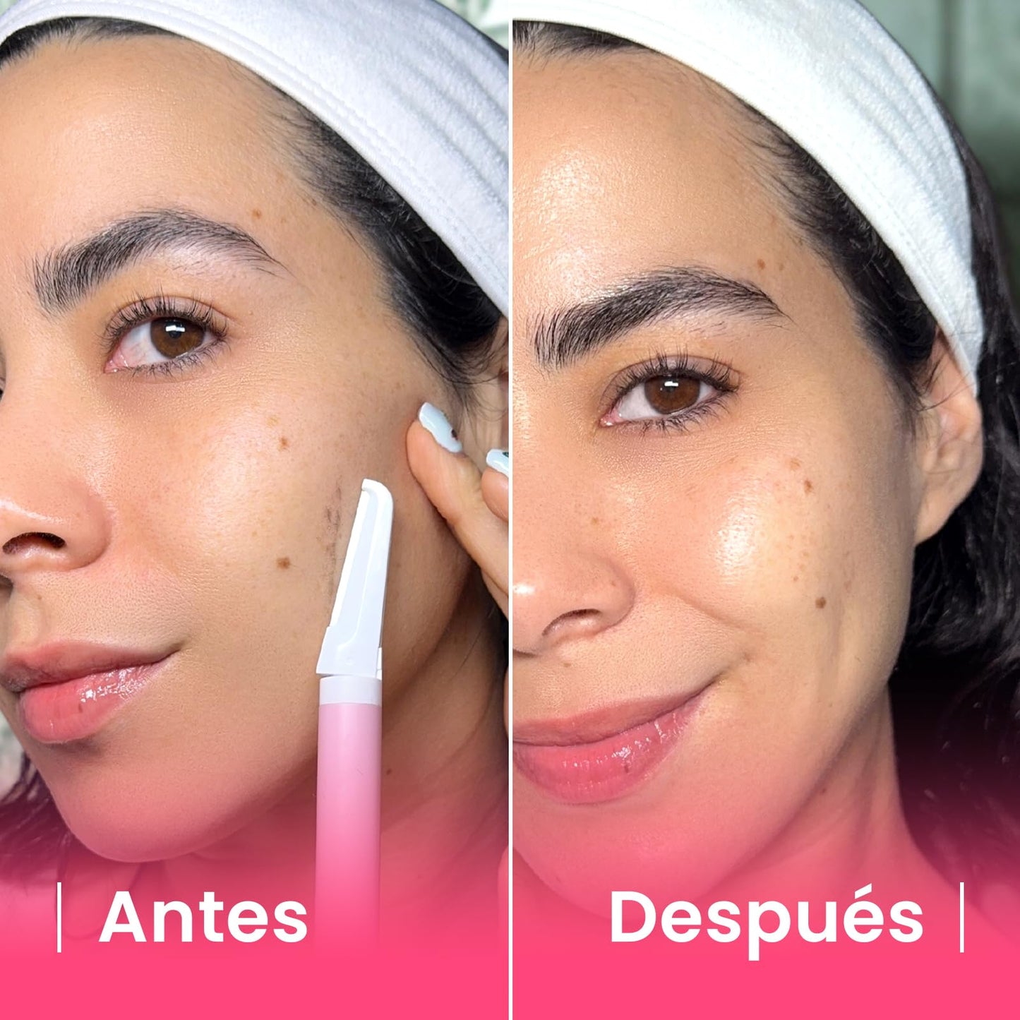 Perfiladora Facial ShinnySkin Removedor Vello Cuchilla Acero