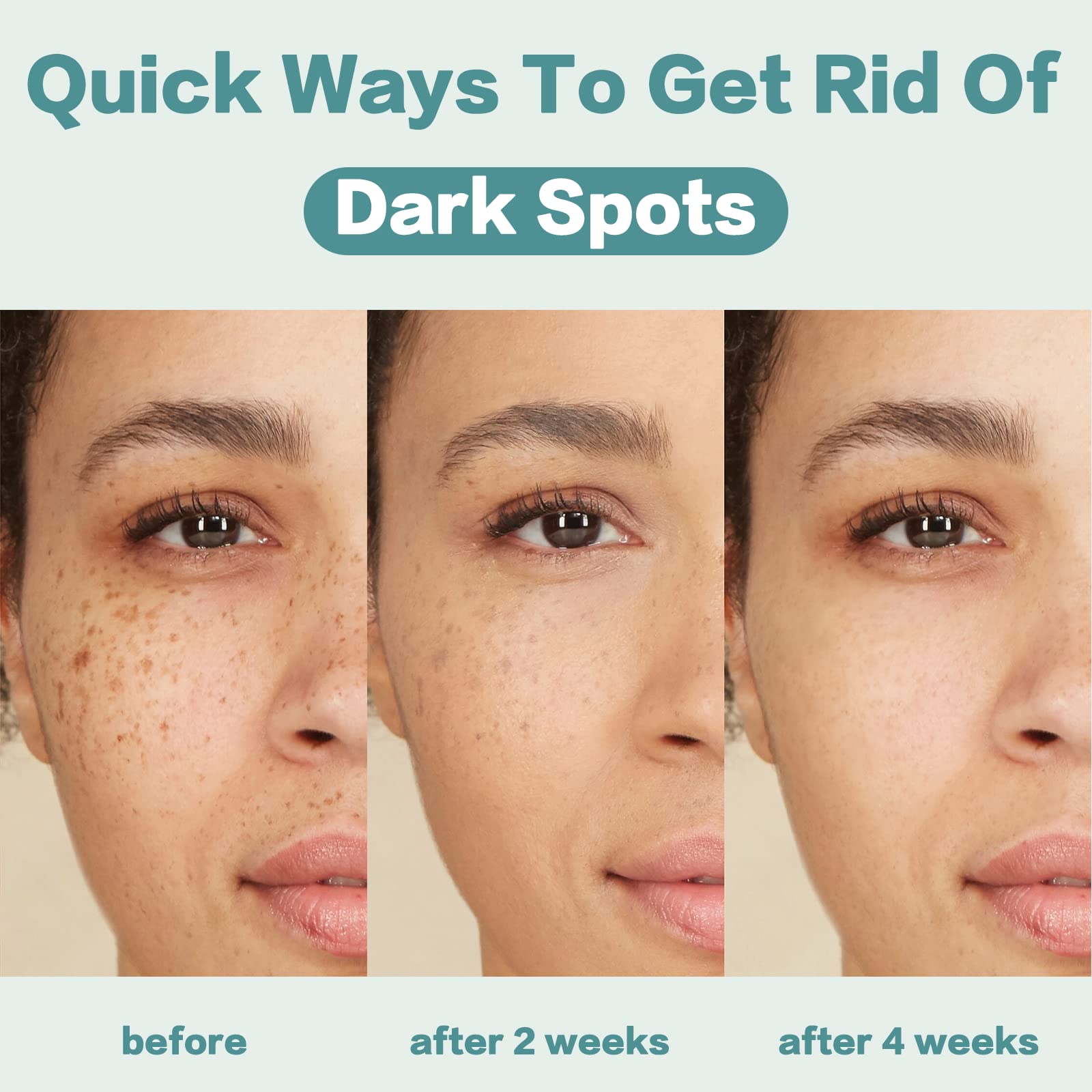 CITYGOO - Eliminador de manchas oscuras para el rostro y cuerpo: crema correctora de manchas oscuras con ingredientes naturales y efectivos para una piel radiante