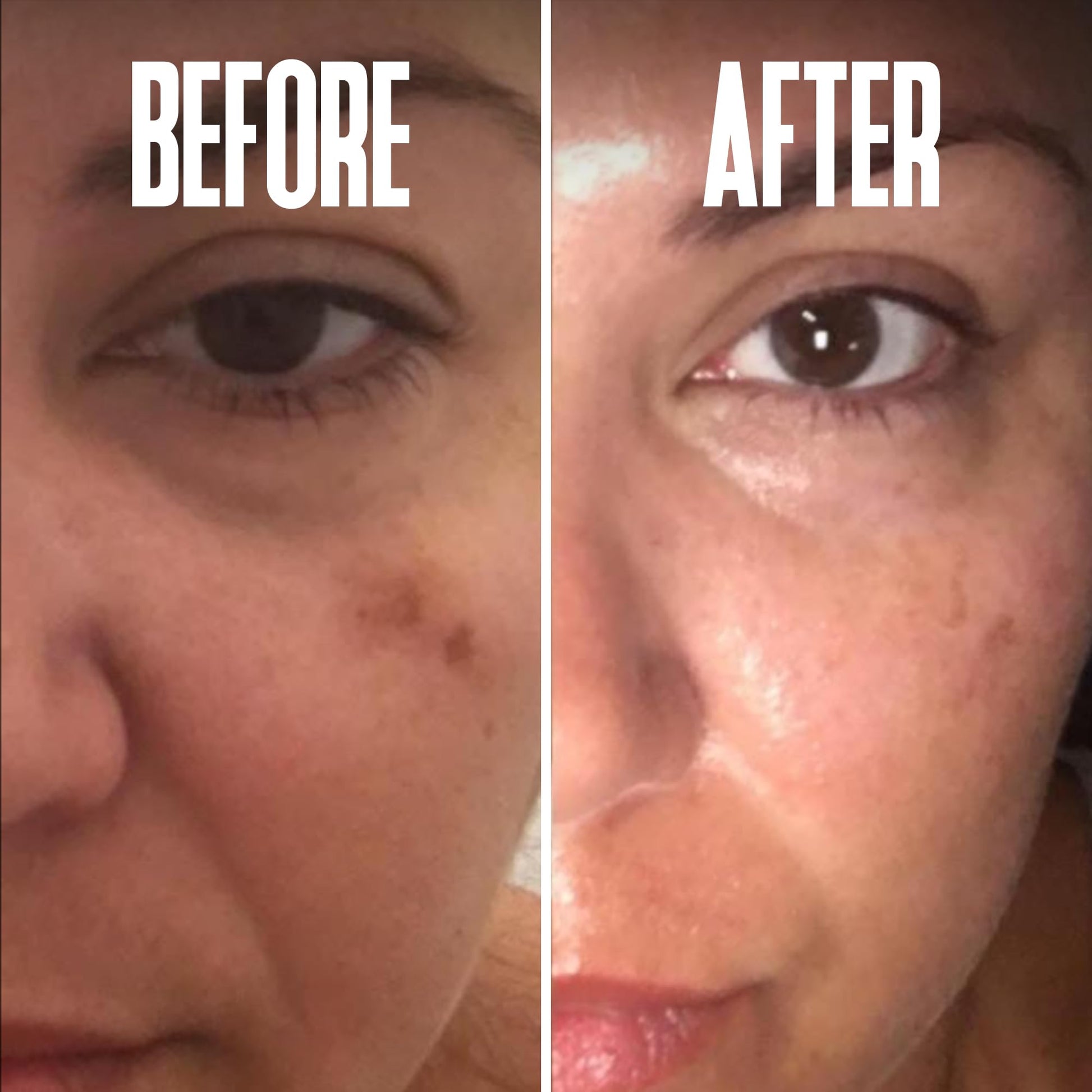 Divine Derriere Skin Lightening 2% Hydroquinone Dark Spot Corrector For Face & Melasma Treatment Fade Cream - Contains Vitamin C, Salicylic Acid, Kojic Acid, Azelaic Acid and Lactic Acid 1.0 oz / 30ml