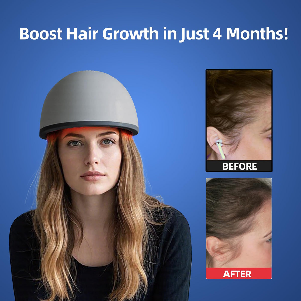 Gorro Láser faq101 Negro para la Regeneración Capilar en Alopecia para Hombre y Mujer
