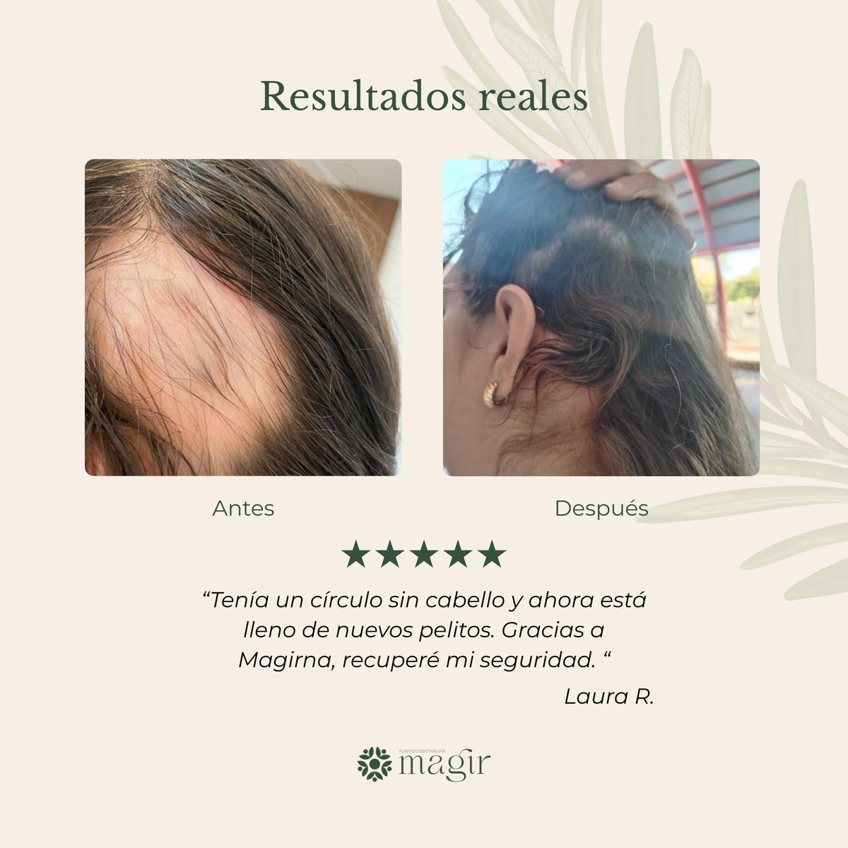 Shampoo Anticaída Magirna con Minoxidil y Biotina, Fortalece y Engrosa el Cabello, Fórmula Intensiva sin Sulfatos ni Parabenos