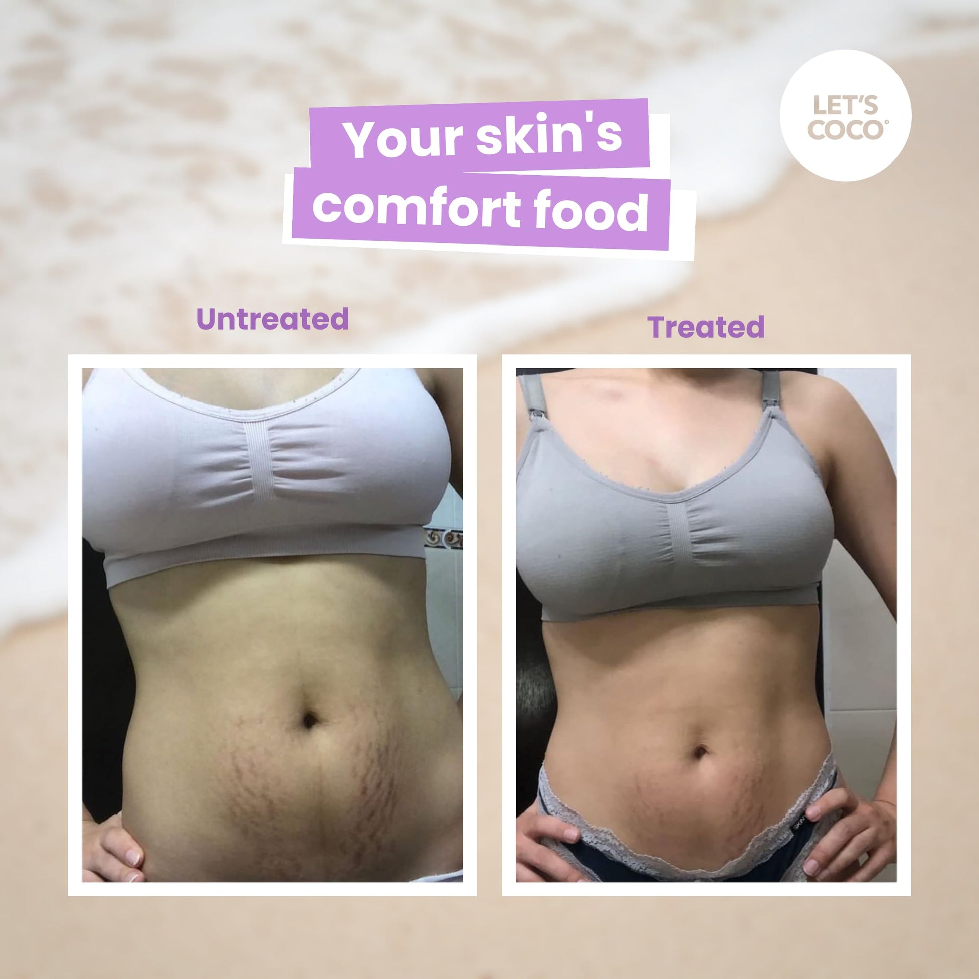 LET'S COCO | Kit Anti-Celulitis y Estrías (Let’s Coco Smooth + Violeta Body Oil) - Exfoliante Corporal de Café, Anti-Celulitis, Para Uso en Todo el Cuerpo y Aceite Corporal de Jojoba y Sándalo