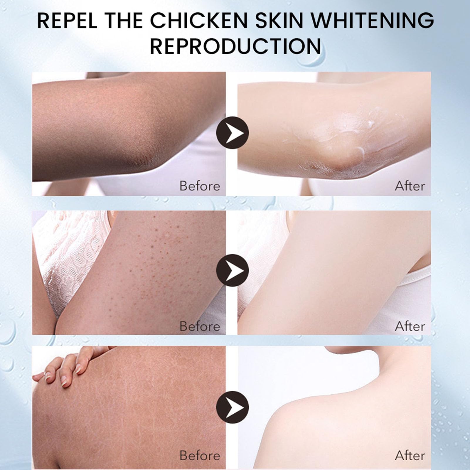 Crema de Queratosis para Suavizar la Piel, Borrador de Protuberancias, Exfoliación con Vitamina E - Solución Diaria para el Cuidado de la Piel, Material Orgánico, Alivio