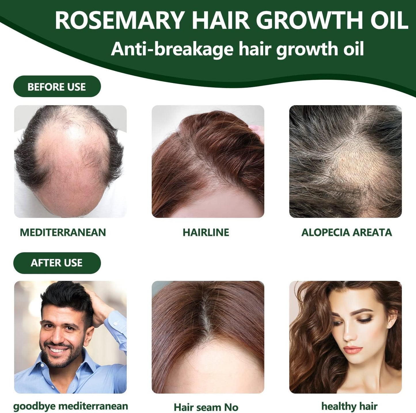 Pack de 2 Aceites de Romero para Estimular el Crecimiento y Nutrir el Cabello, 30ml