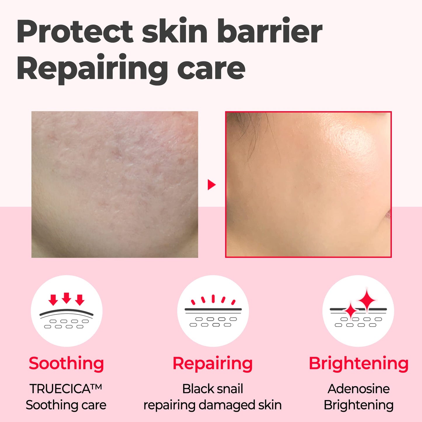 Somebymi Snail Truecica Miracle Repair Serum