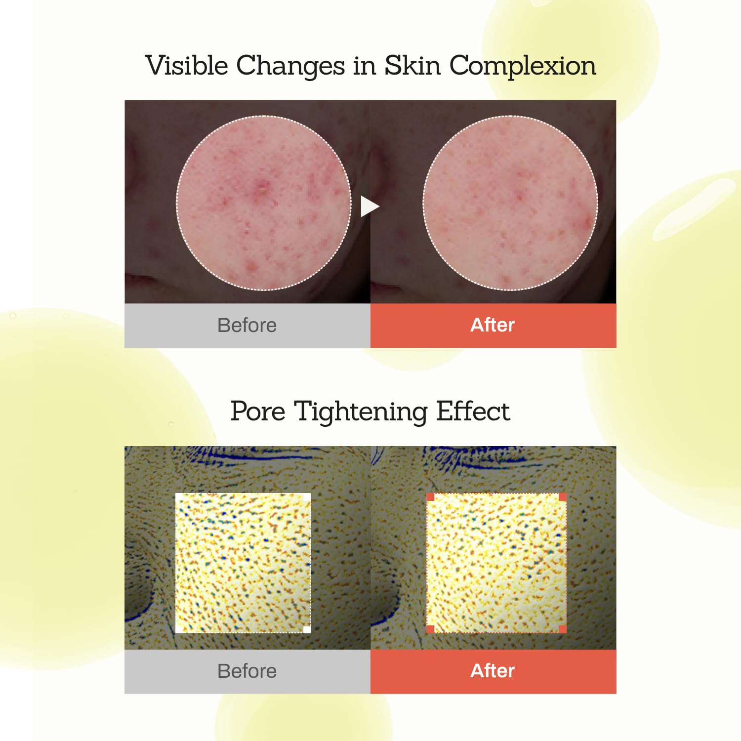 Suero potenciador de la piel de retina Suero avanzado de retinol para el rostro Suero facial hidratante y reafirmante para tono de piel irregular y líneas finas Brillo radiante y juvenil con
