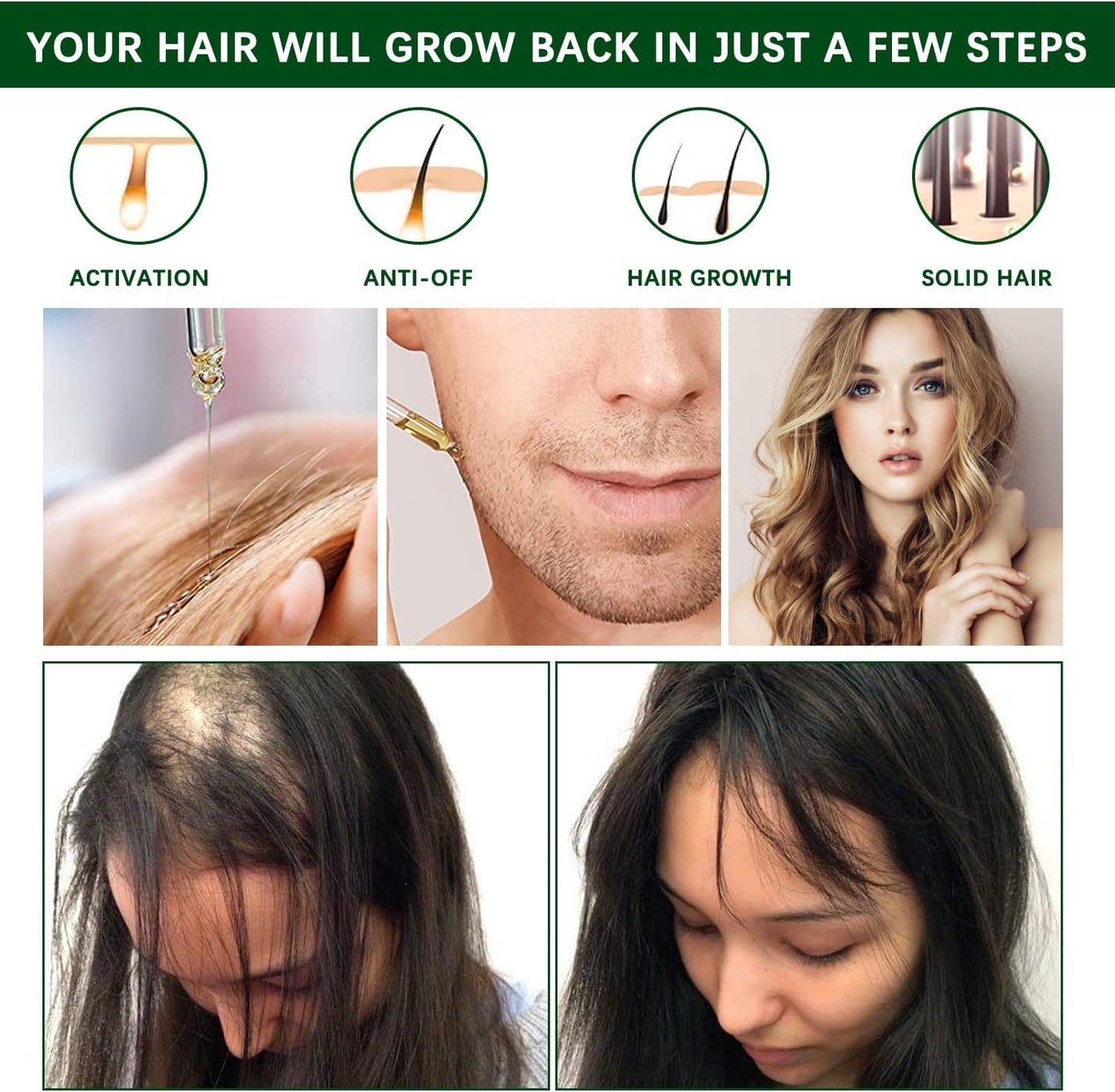 Pack de 2 Aceites de Romero para Estimular el Crecimiento y Nutrir el Cabello, 30ml