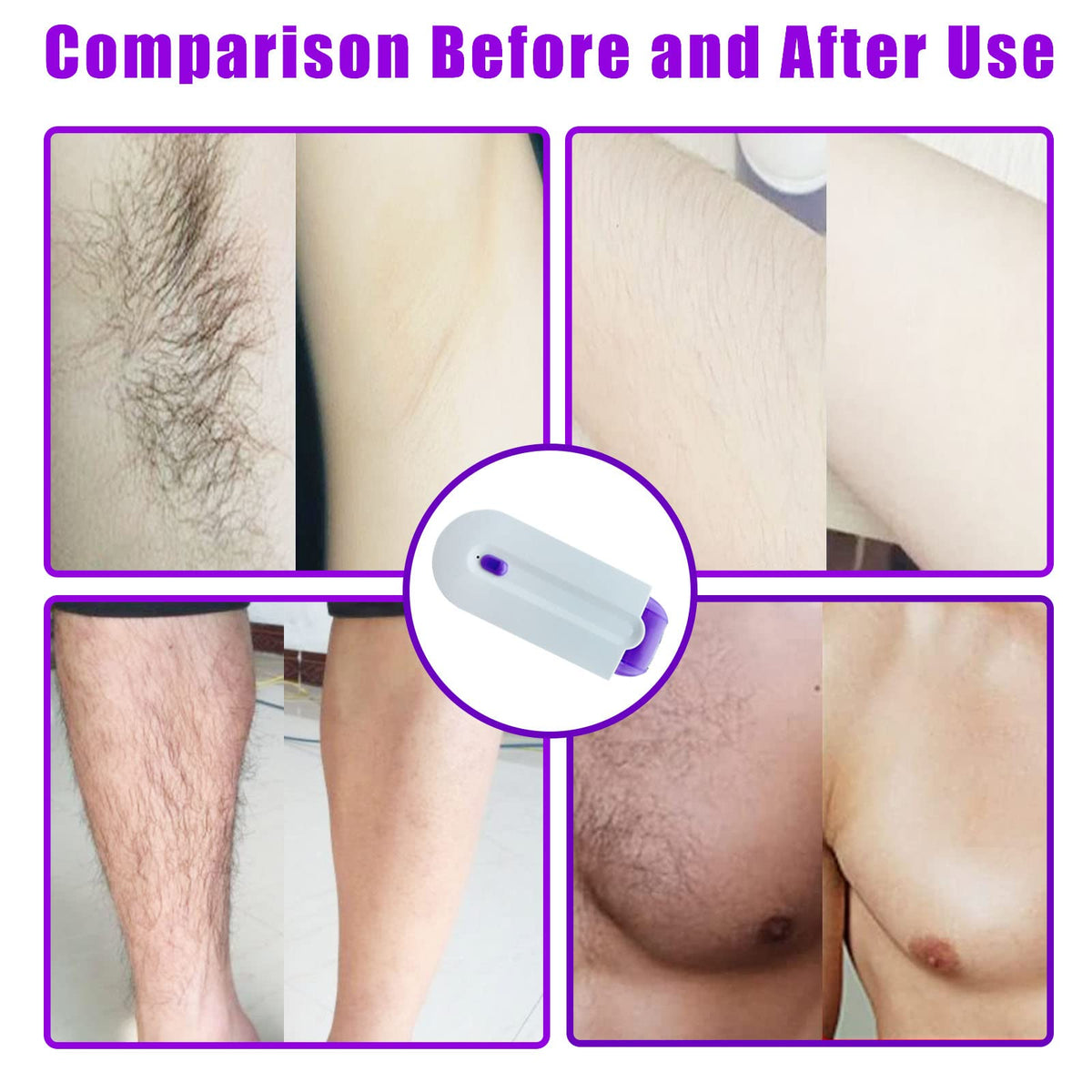 GNDROO Borrador de Pelo Suave y Sedoso de Enfoque, Herramienta Portátil de Depilación Indolora, Depiladora Recargable, Removedor de Vello Suave Al Tacto, Aplicable A Cualquier Parte Del Cuerpo, Regalo