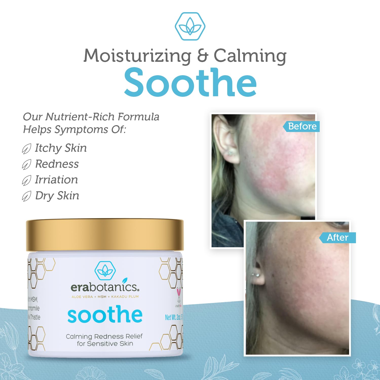 Rosacea Redness Relief Treatment Cream - Soothe Anti Inflammatory Natural Face Moisturizer Cream For Rosacea, Eczema, Acne, Dry, Sensitive Skin With Milk Thistle, MSM, Avocado Oil & Chamomile