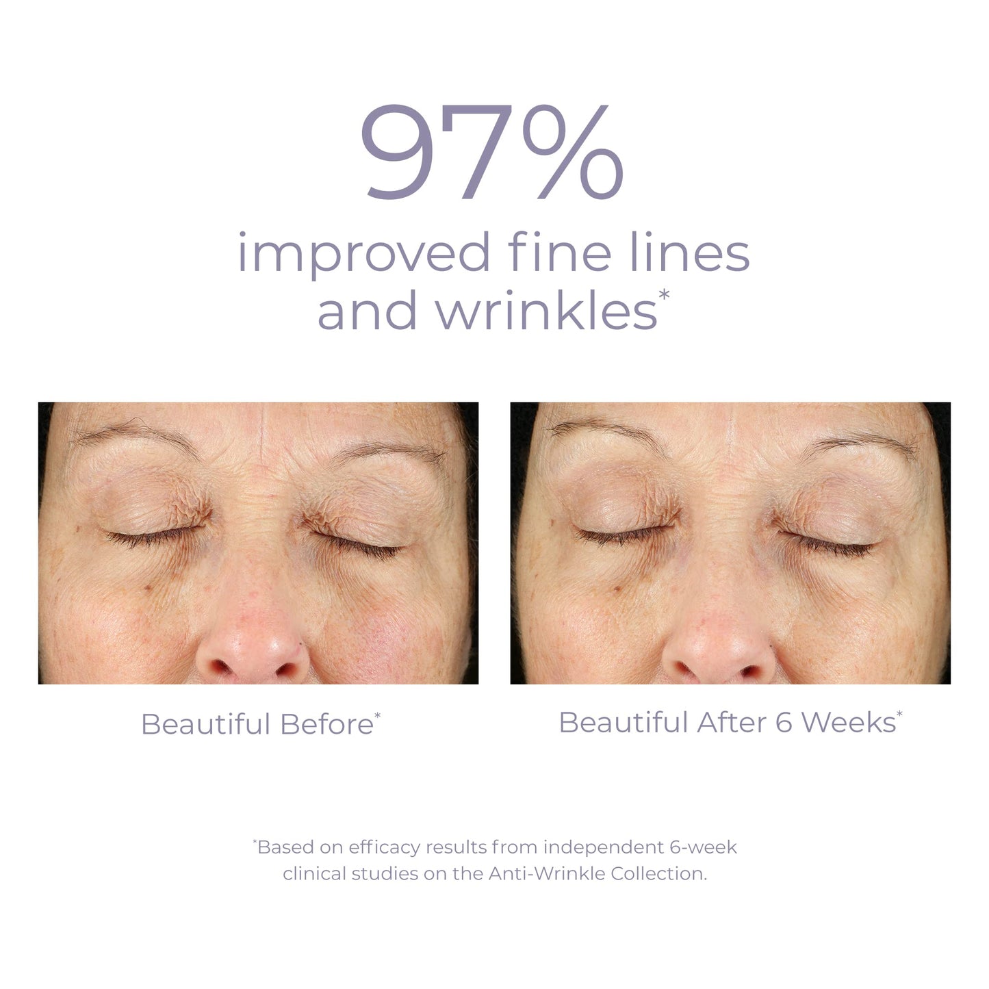 DERMA-E VIOPY derma e Anti-Wrinkle Vitamin A Retinyl Palmitate Creme