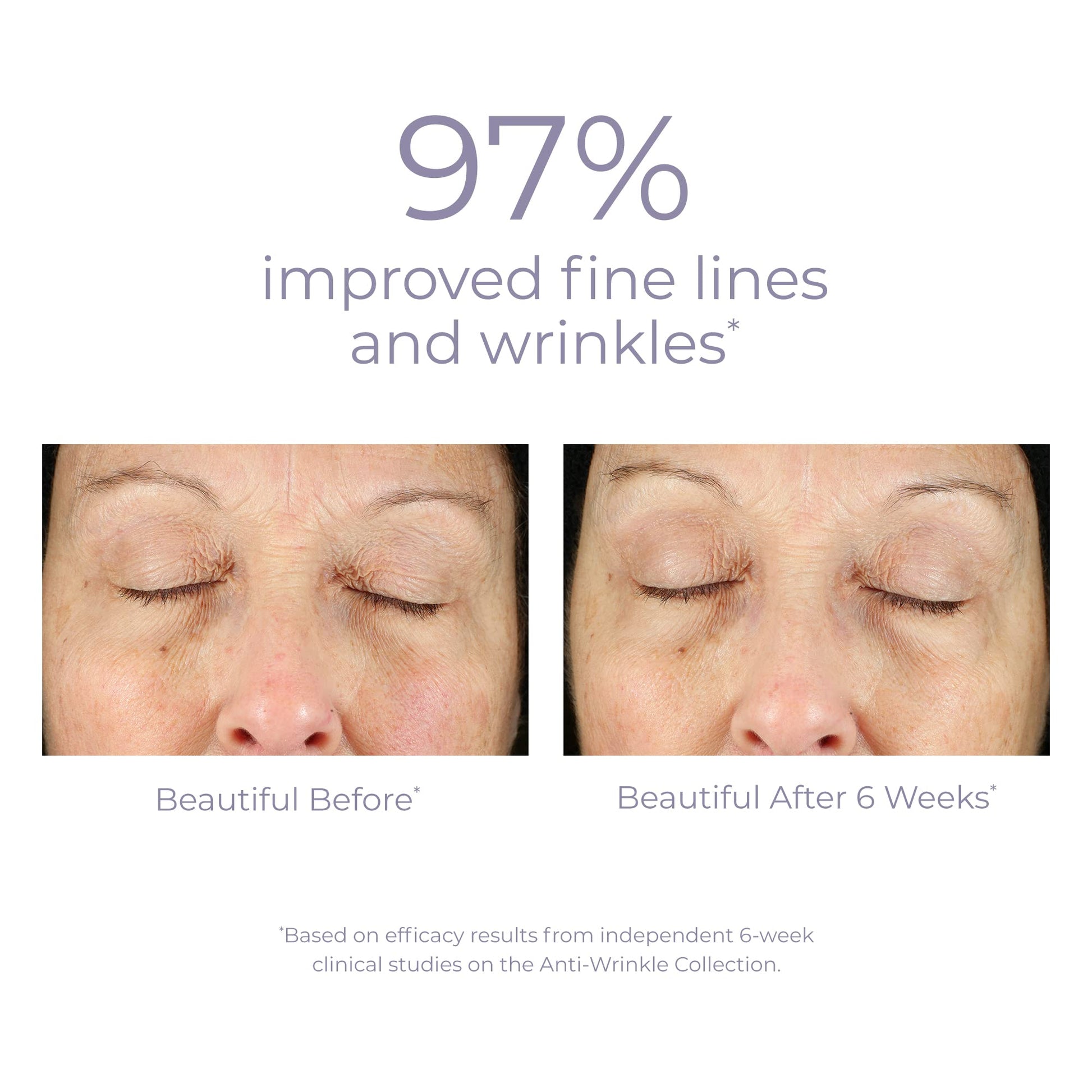 DERMA-E VIOPY derma e Anti-Wrinkle Vitamin A Retinyl Palmitate Creme
