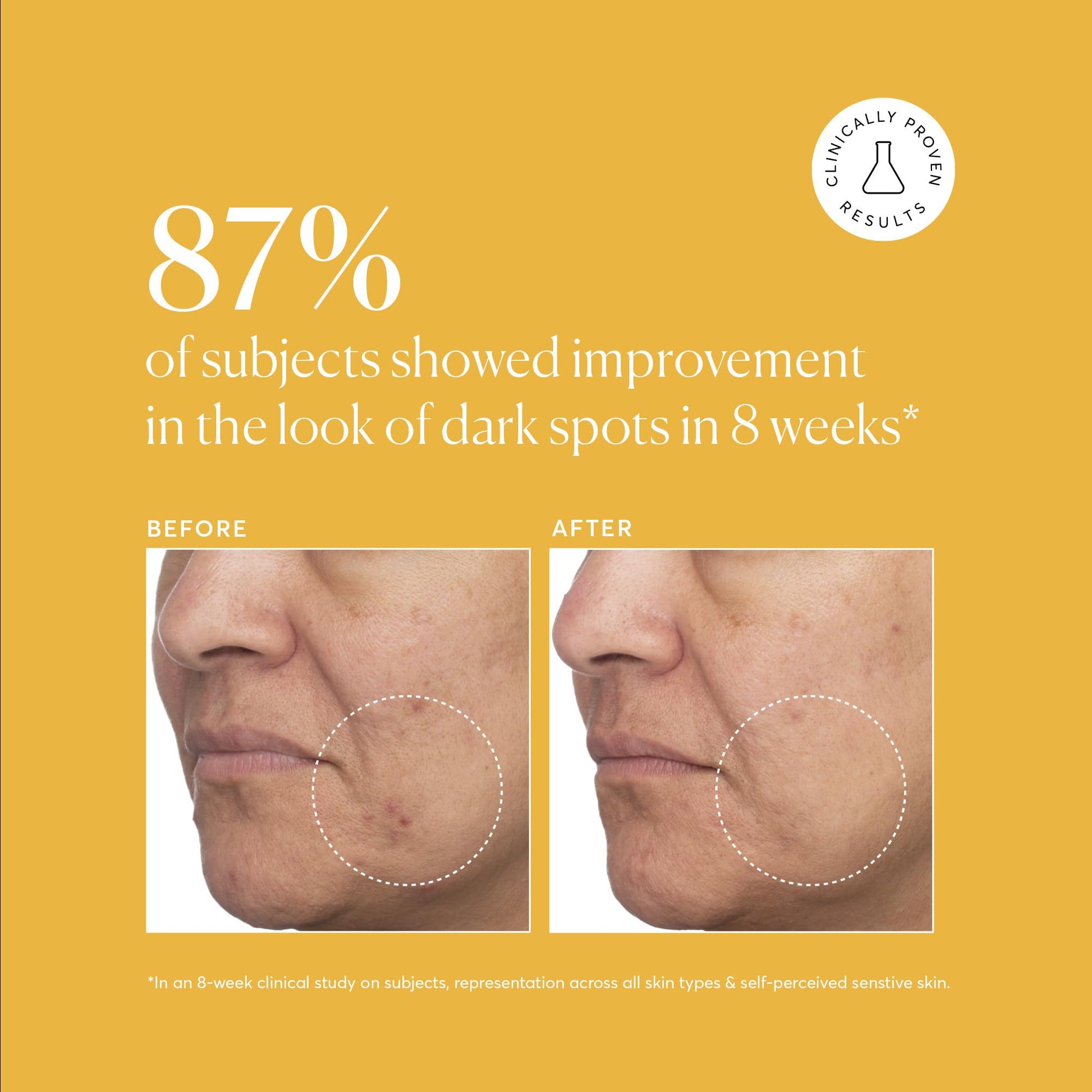 Naturium Ácido tópico tranexámico 5%, más ácido kójico, niacinamida y raíz de regaliz, tratamiento de cuidado facial y piel, removedor de manchas oscuras, 1 onza