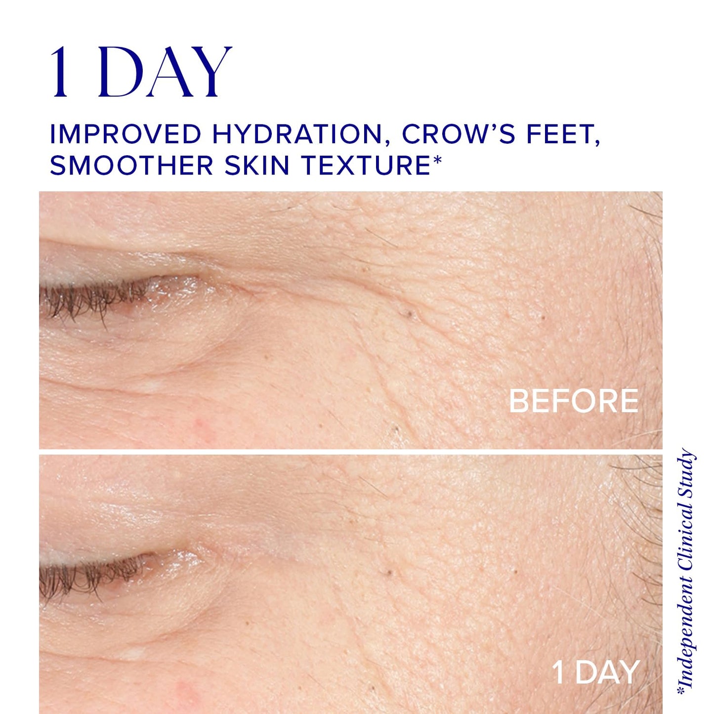 iS CLINICAL Youth Intensive Crème, 1.7 Oz
