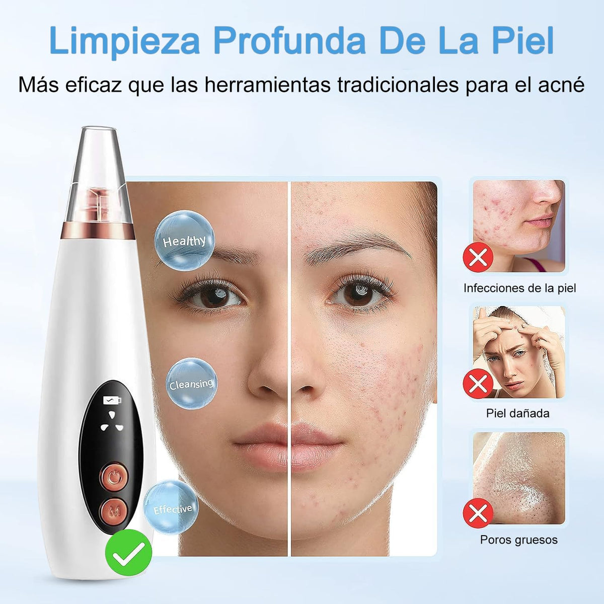 Removedor de puntos negros electrico, Juego de 23 Piezas Limpiador de Poros, extractor de espinillas nariz con Pantalla LED, 6 Sondas de Succión y 3 Modos, USB Recargable