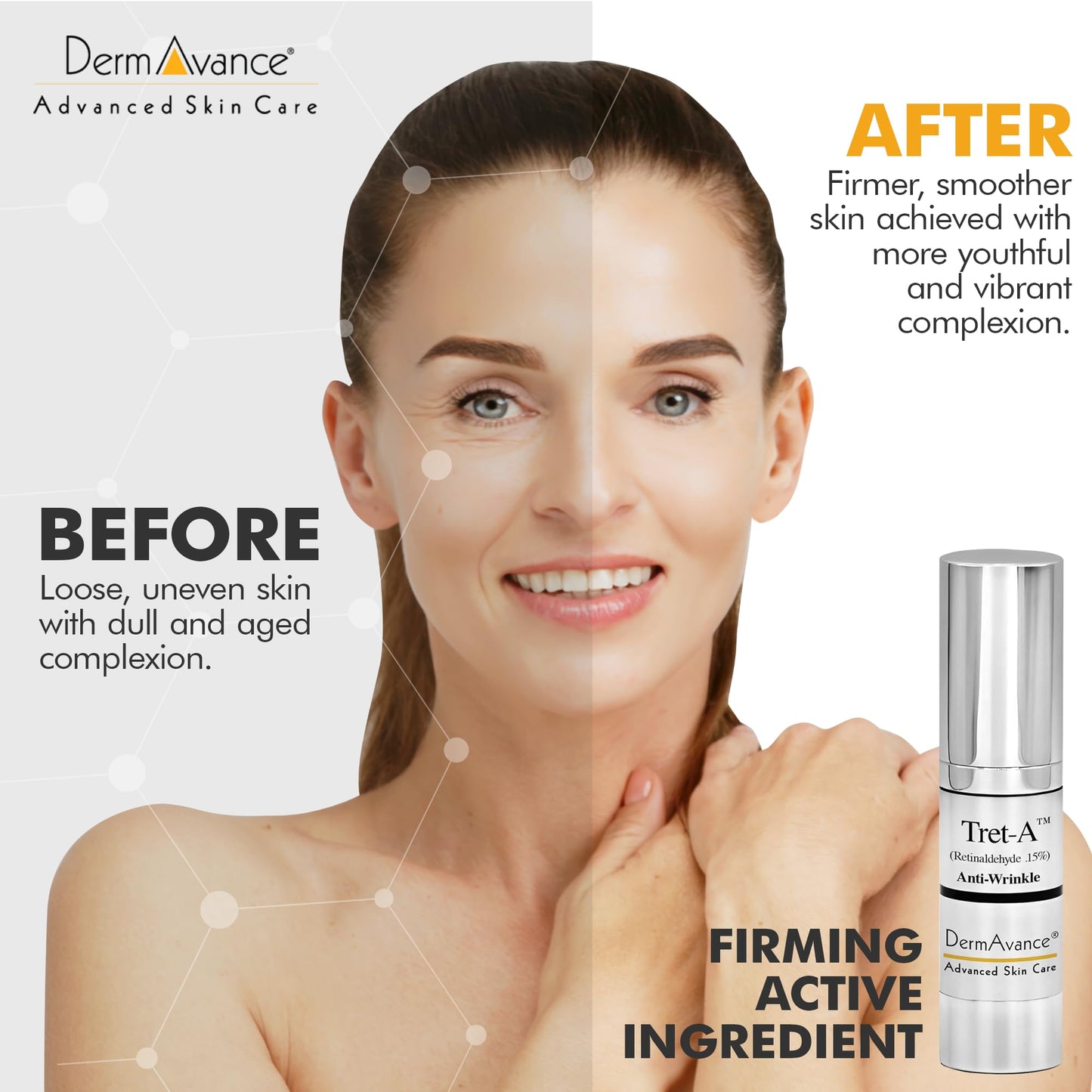 Tret-A (Retinaldehyde 0.15% Lotion The Strongest Advanced Anti-Aging and Brightening Facial Treatment 15ml