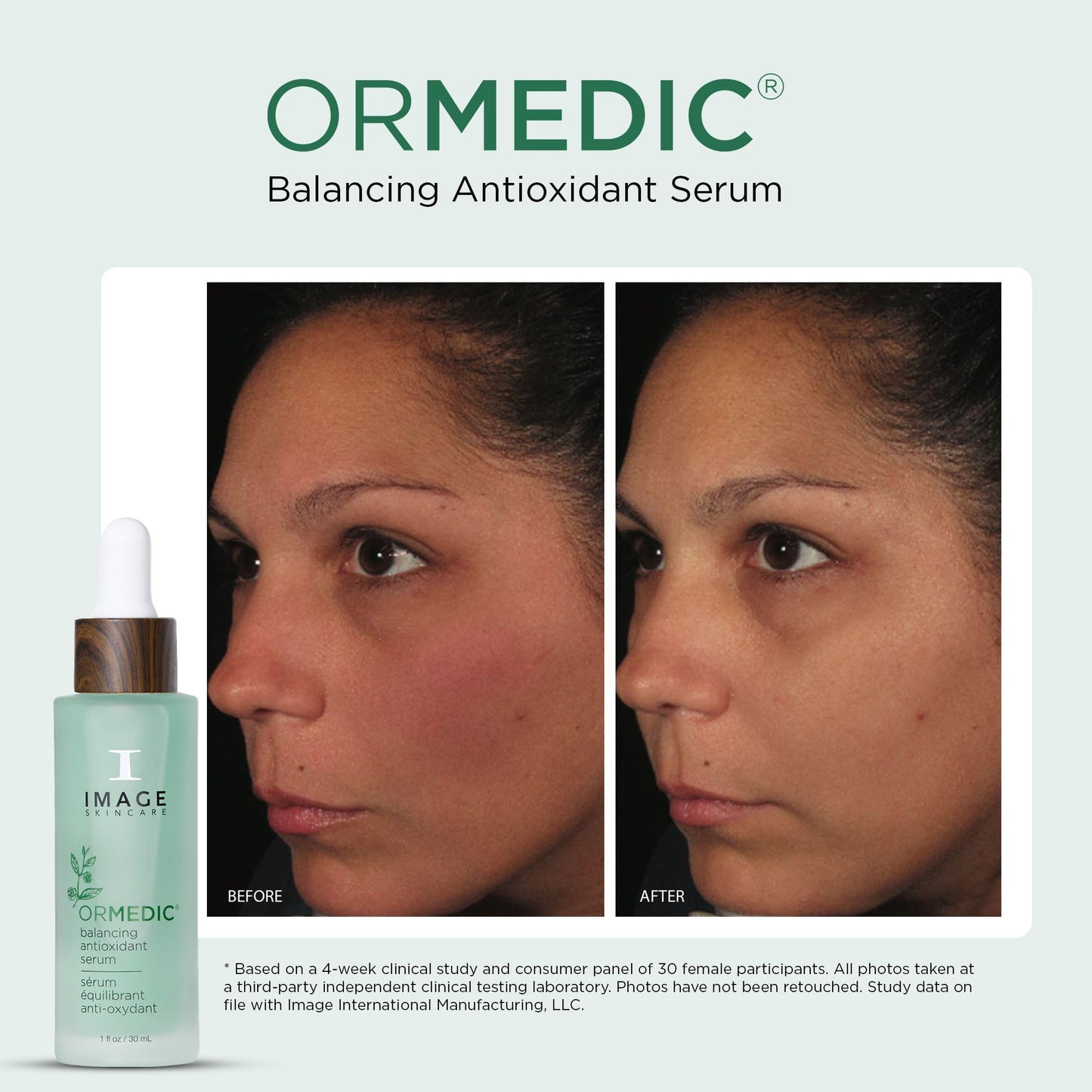 IMAGE Skincare ORMEDIC Balancing Antioxidant Serum 1oz.
