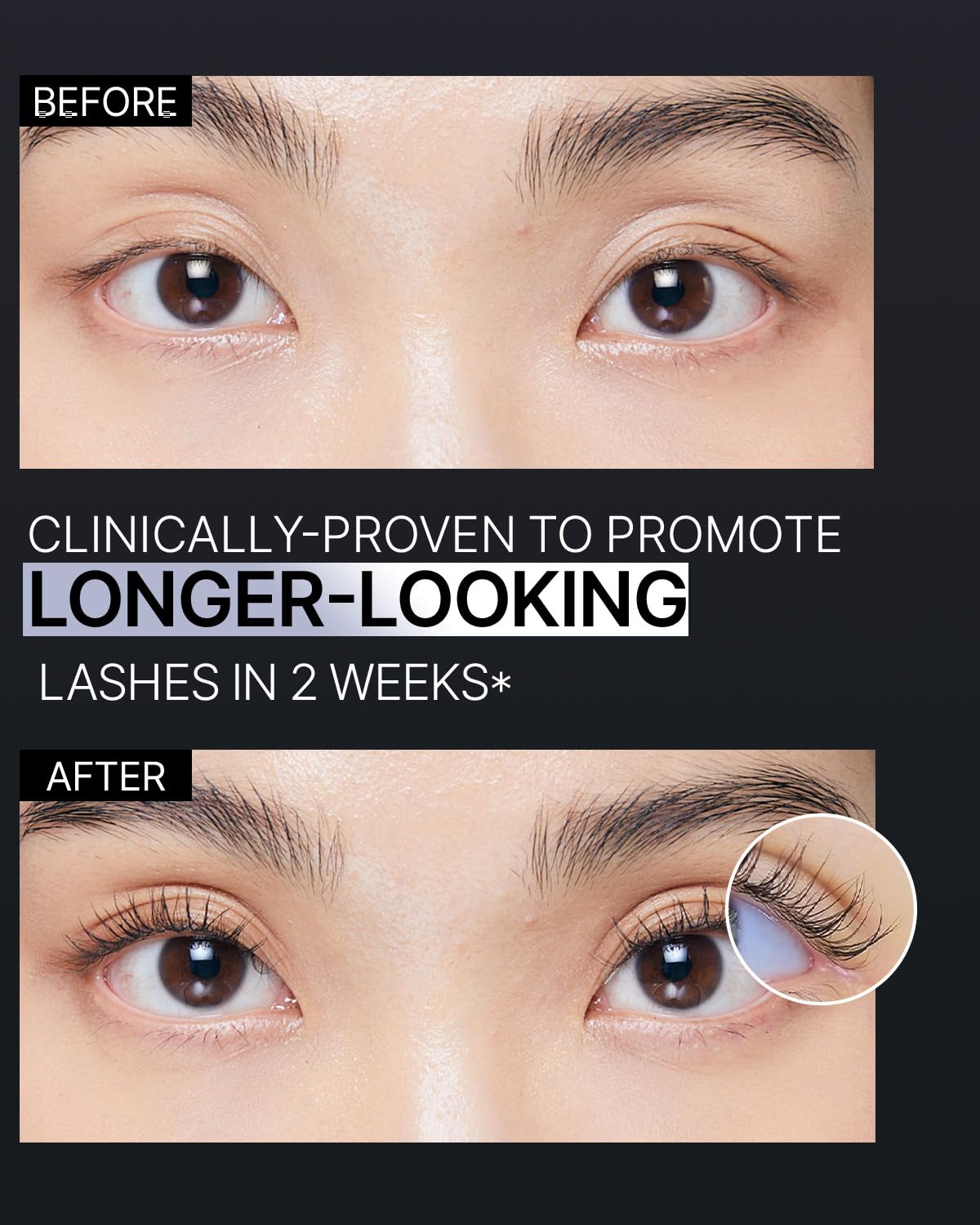 EPAIS Essential Eyelash Growth Serum, Jumbo Size 15ml/0.5fl.oz - Safe & Gentle Lashes Care, Nutrient Formula for Longer, Fuller, Thicker in 2 Weeks, Peptides, Biotin, Non-Prostaglandin, Paraben-Free
