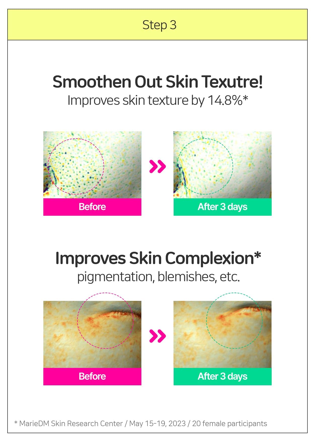 BRINGGREEN Zinc Teca Trouble Serum | Suero para el acné, cuidado de la piel coreano, suero facial, 3 días, cuidado de los poros