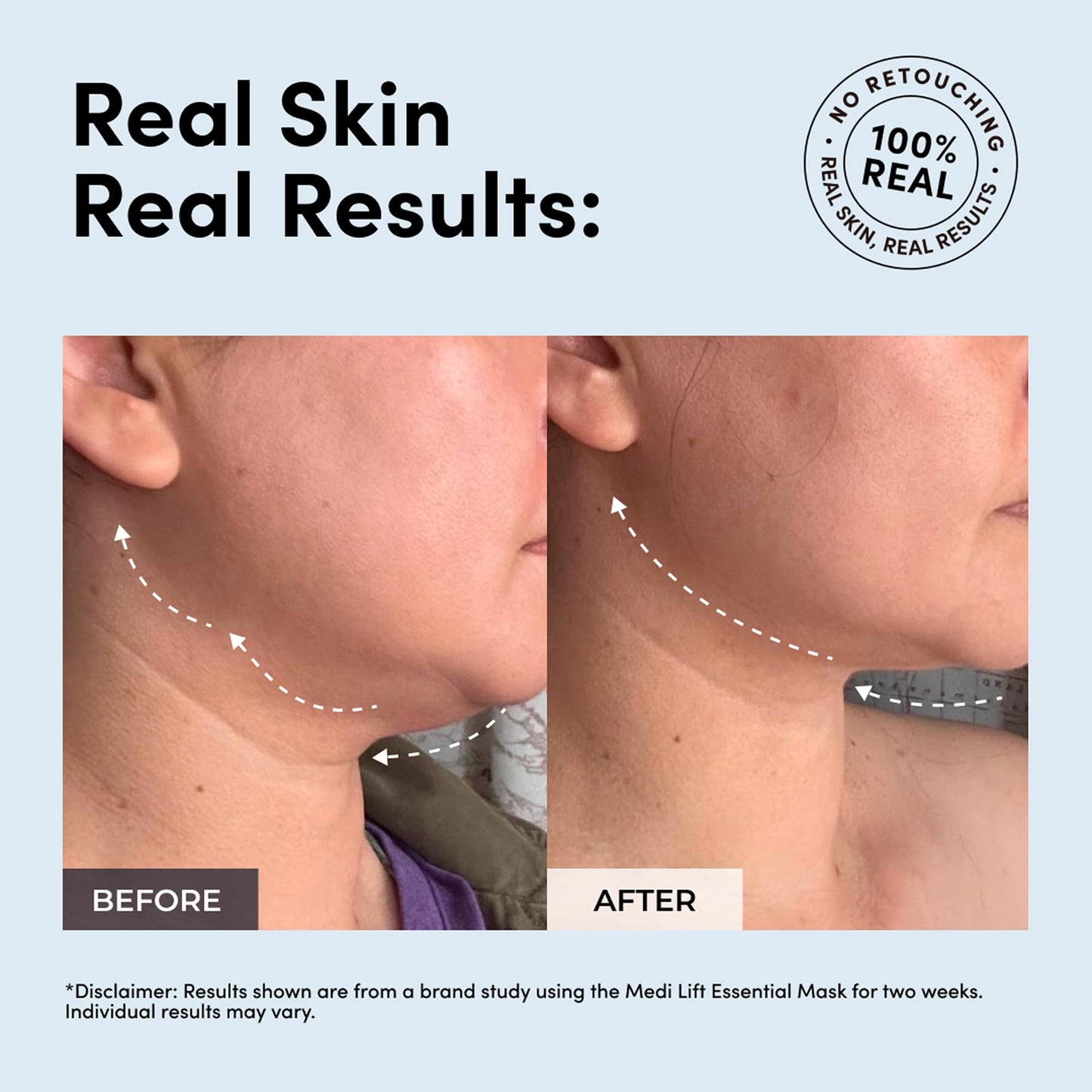 MEDI LIFT Esencial - Mascarilla, Belleza Portátil Manos Libres