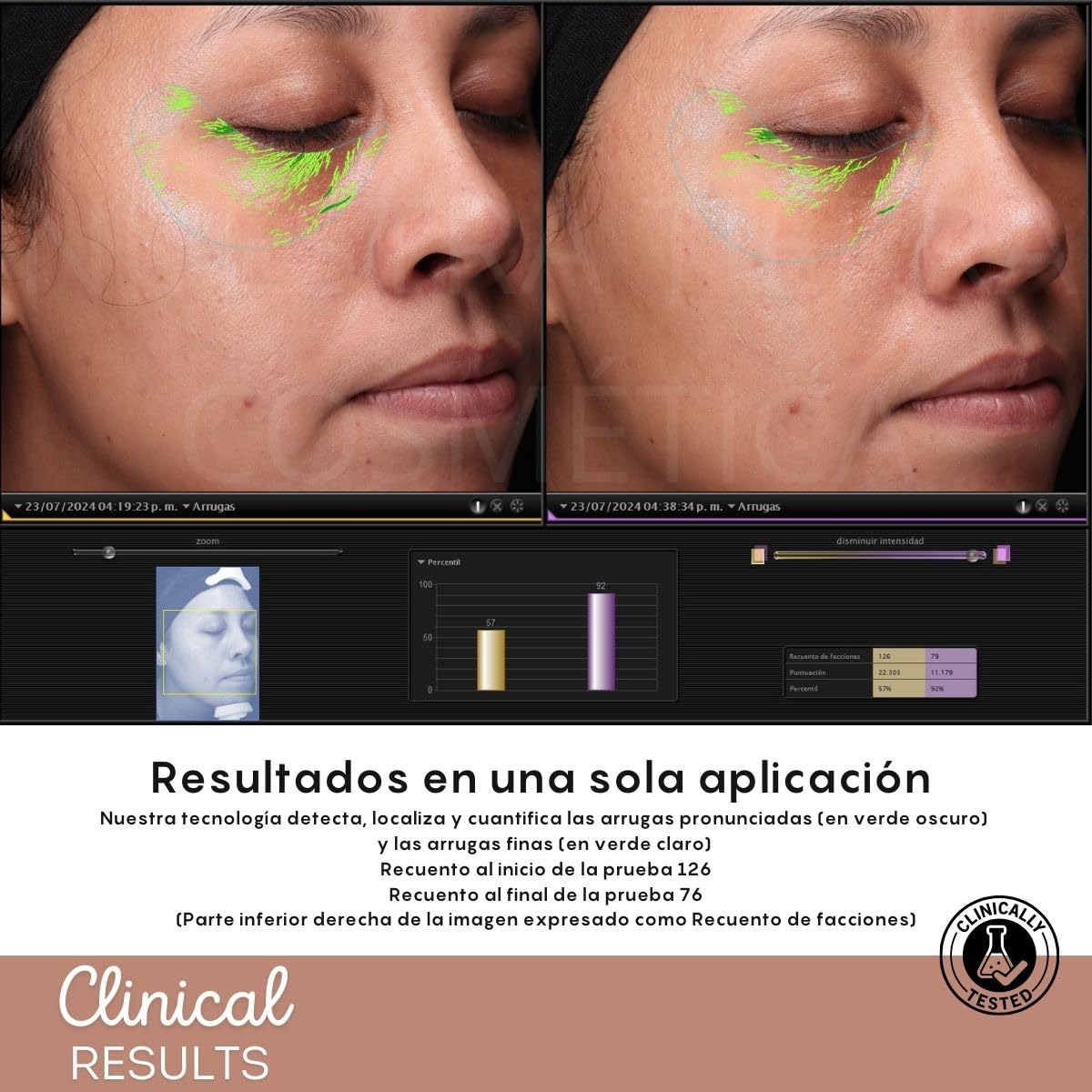 Lifting Facial Serum