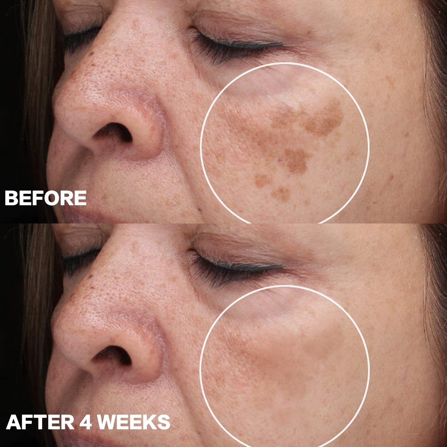 CITYGOO - Eliminador de manchas oscuras para el rostro y cuerpo: crema correctora de manchas oscuras con ingredientes naturales y efectivos para una piel radiante