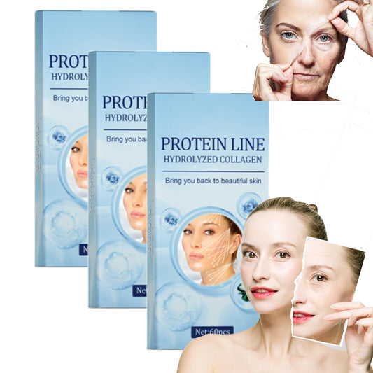Hilo de proteína soluble coreano, hilo de colágeno para levantar instantáneamente la proteína facial, hilos de colágeno absorbentes, juego de levantamiento de hilos de proteína, reduce las arrugas de líneas finas, para mujeres (3 cajas)