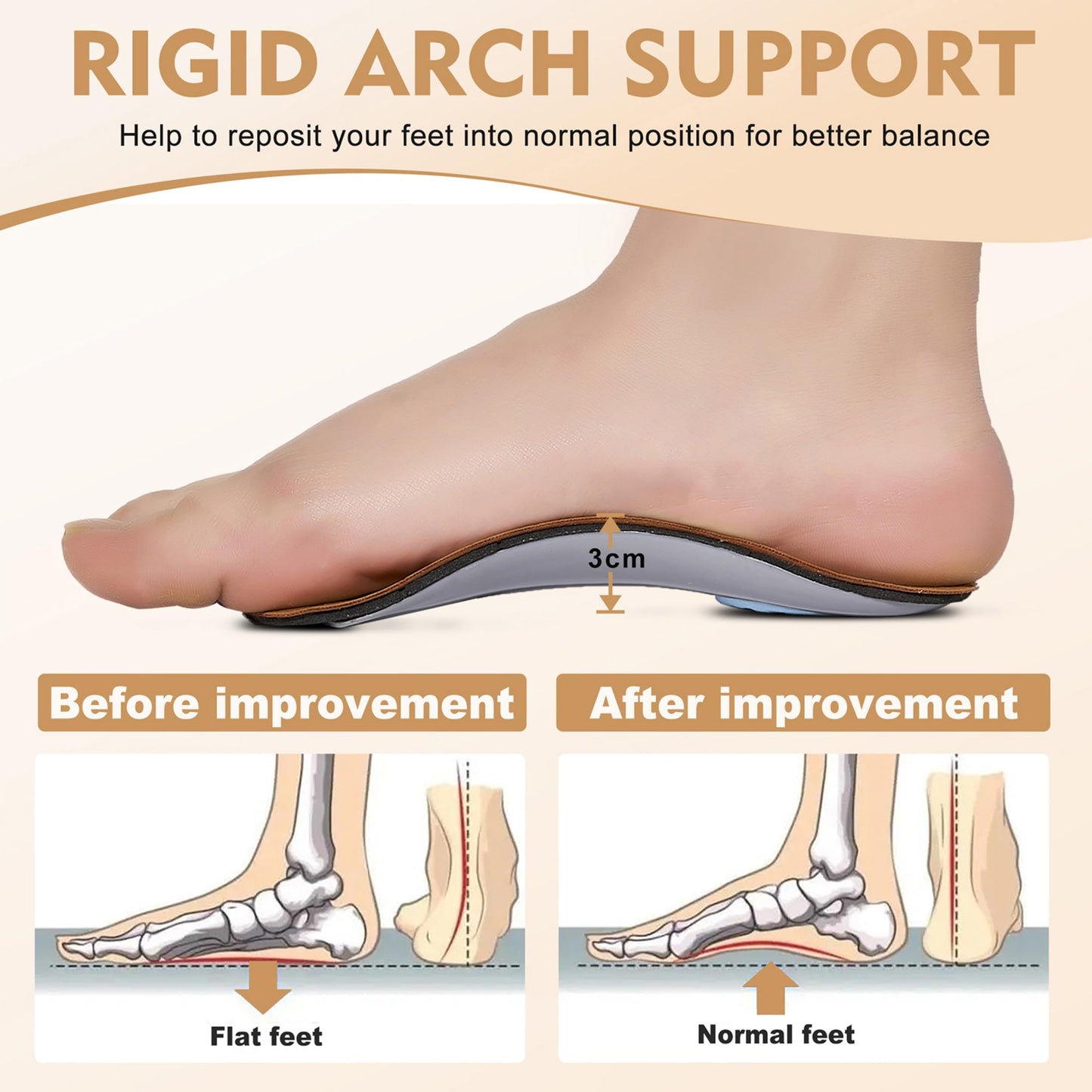 Insertos ortopédicos de longitud 3/4, soporte de fascitis plantar medio con almohadilla metatarsiana para talón, plantillas de piel ligera para zapatos de pie para mujeres y hombres, soporte de arco alto para pies planos, caminar, ejercicio, XS