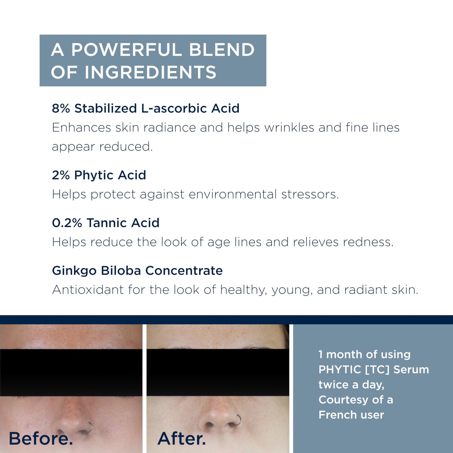 Suero de Phytic [TC] - Escudo de brillo antioxidante y antiarrugas de 30 ml.