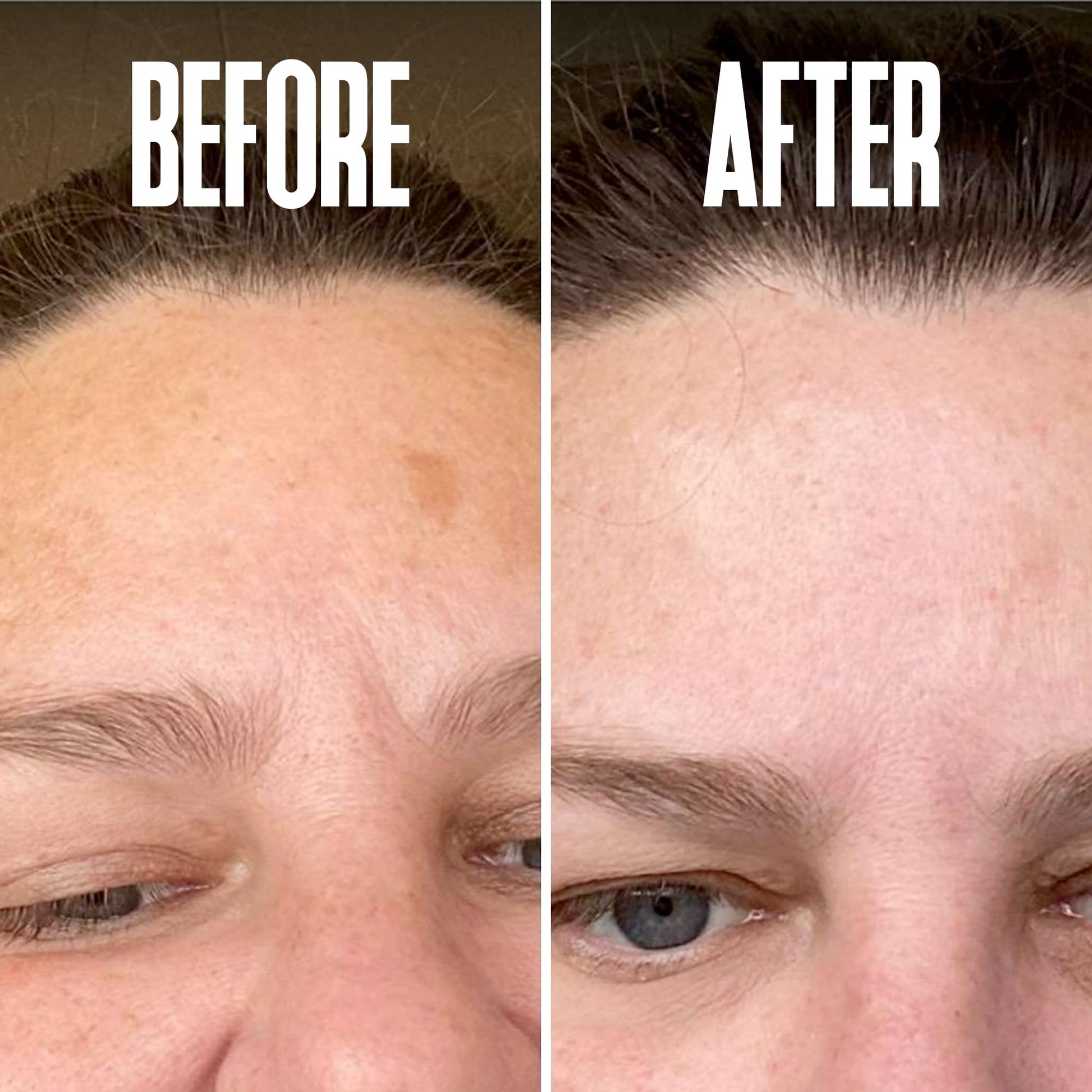 Divine Derriere Skin Lightening 2% Hydroquinone Dark Spot Corrector For Face & Melasma Treatment Fade Cream - Contains Vitamin C, Salicylic Acid, Kojic Acid, Azelaic Acid and Lactic Acid 1.0 oz / 30ml