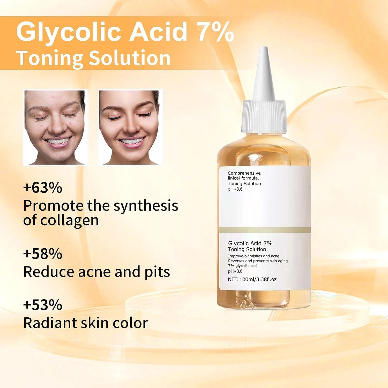 Tónico Facial The Ordinary Ácido Glicólico para Rejuvenecer y Exfoliar la Piel