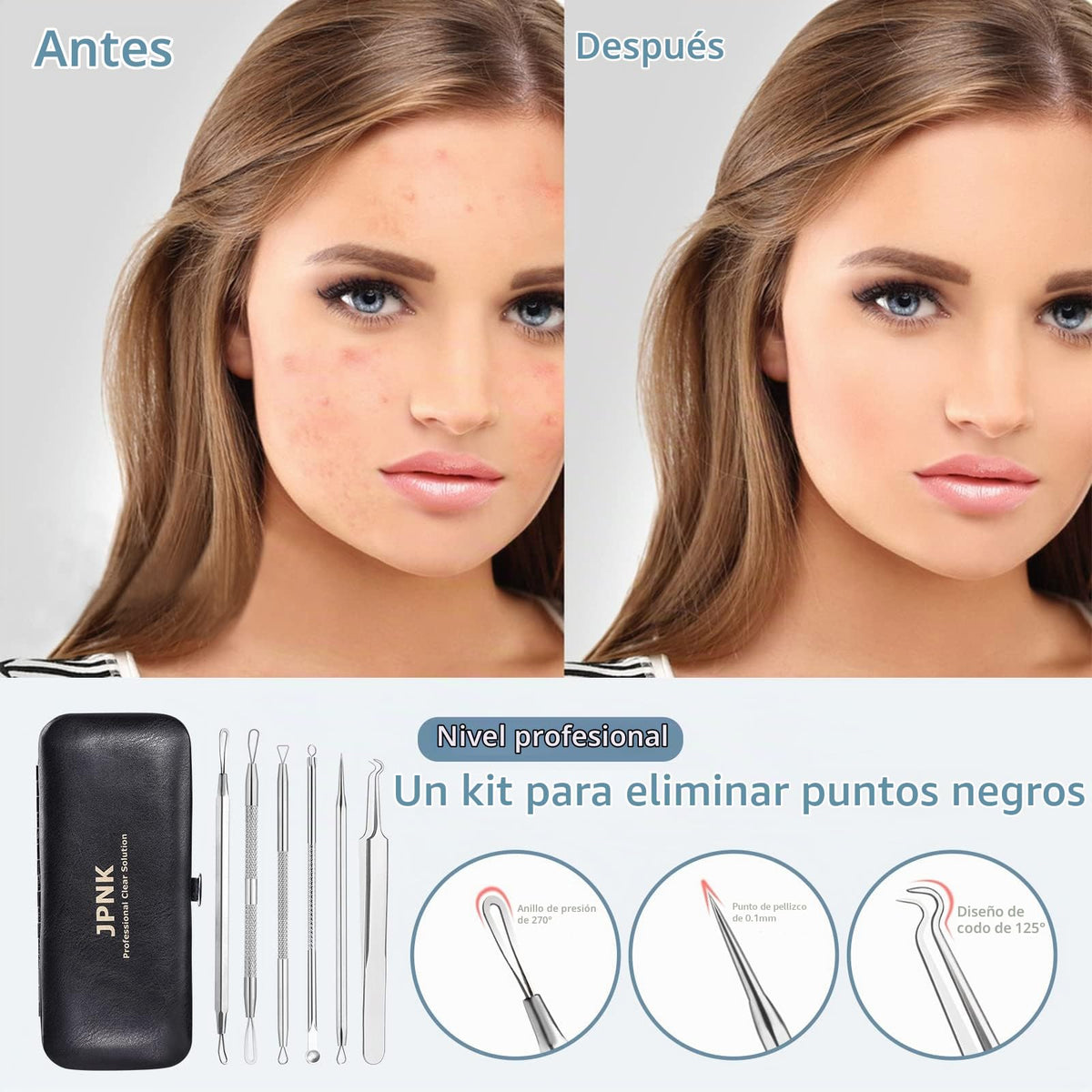 JPNK Blackhead Remover Tools 6 PCS with a Leather bag