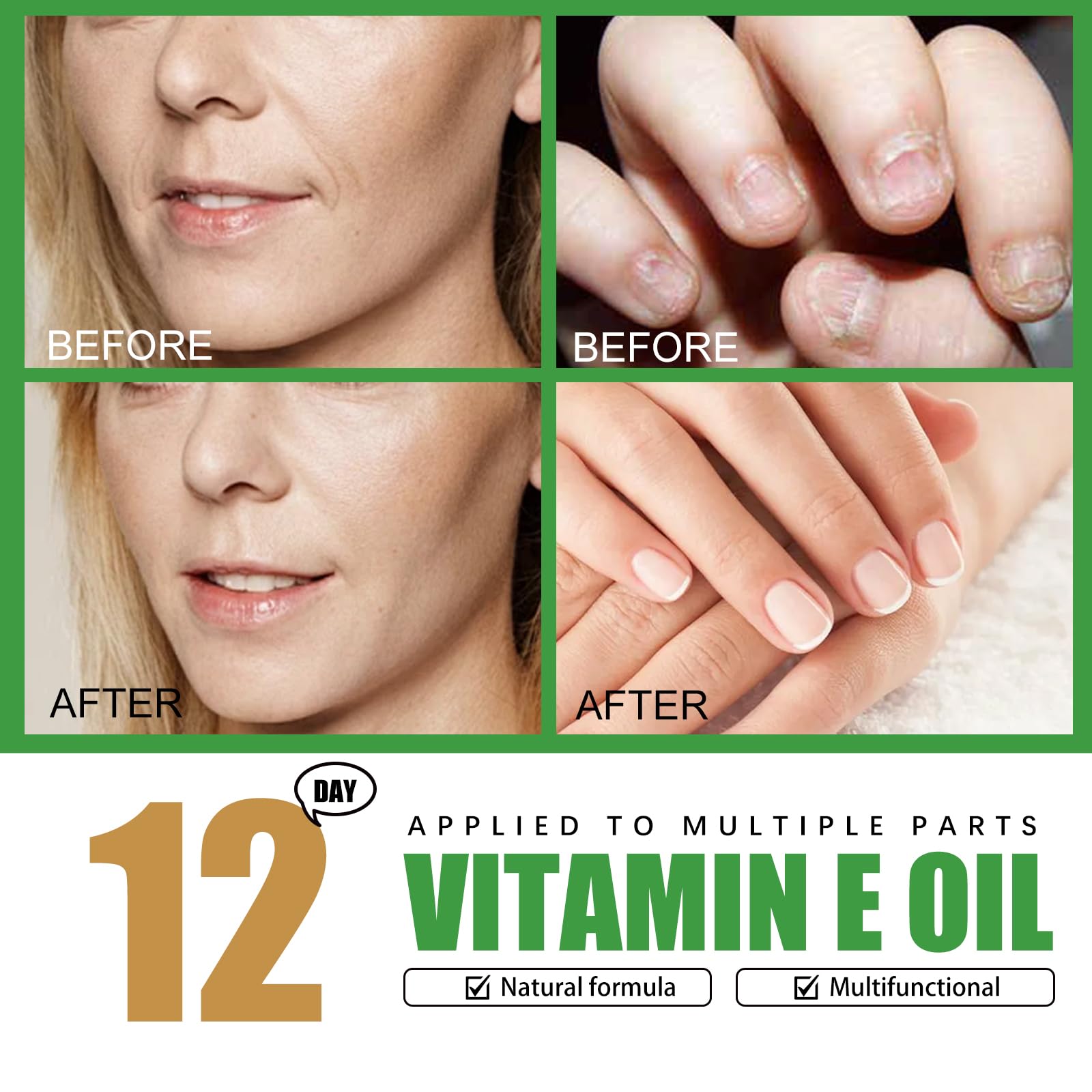 Genérico Aceite de Vitamina E de 59 ml para Cicatrices en la Piel, Cuerpo, Rostro, Cabello, Cuidado de Las uñas, fórmula Pura y Natural Que Ayuda a nutrir la Piel