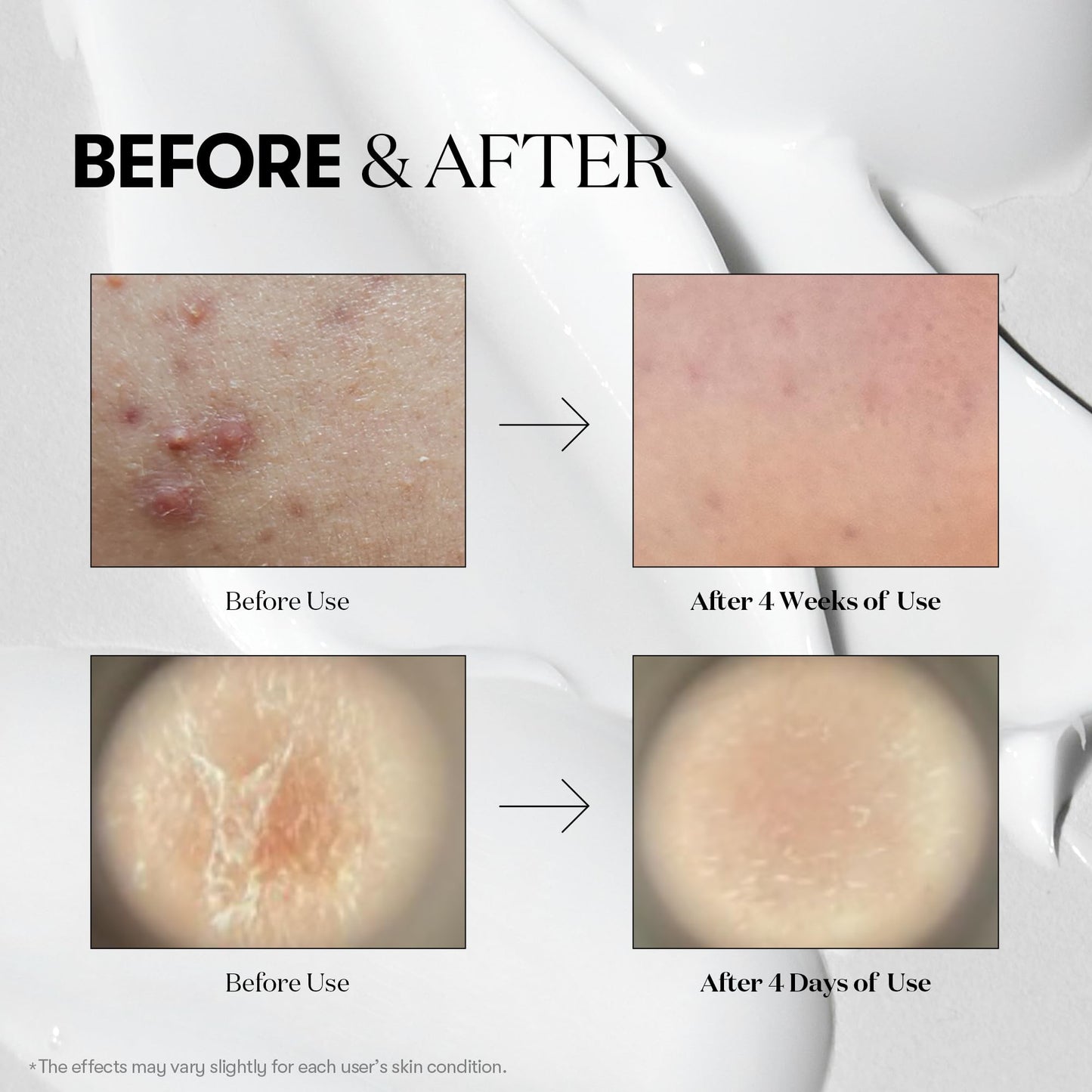 VT COSMETICS CICA Reedle Shot 100, suero de microagujas para uso diario y nocturno con exosomas, centella asiática, ácido hialurónico, propóleo, piel suave, regeneración, piel de cristal, potenciad